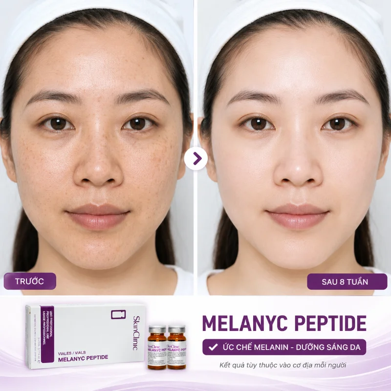 Tinh Chất Hỗ Trợ Mờ Nám, Dưỡng Sáng Da MELANYC Peptide Meso SkinClinic 1 Lọ Chính Hãng