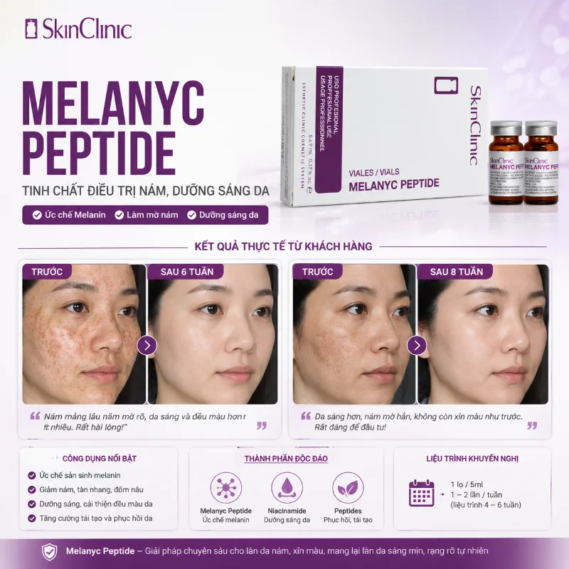 Tinh Chất Hỗ Trợ Mờ Nám, Dưỡng Sáng Da MELANYC Peptide Meso SkinClinic 1 Lọ Chính Hãng