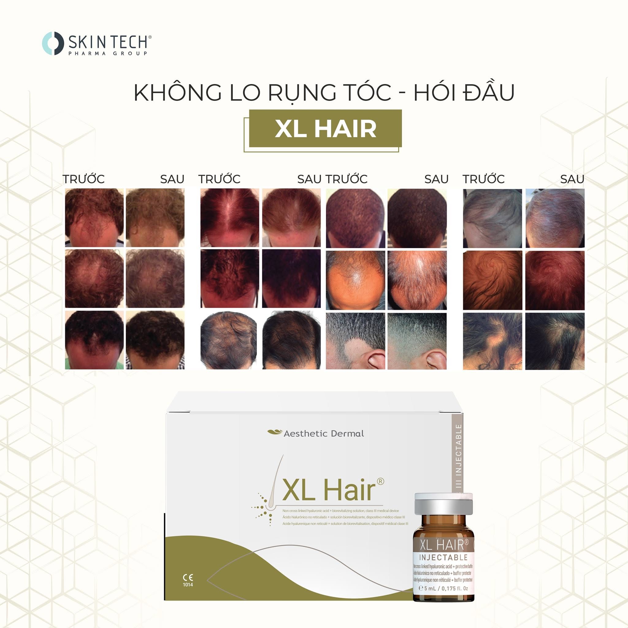 Tinh chất meso kích thích mọc tóc, dưỡng tóc dài khỏe RRS XL Hair SkinTech 5ml