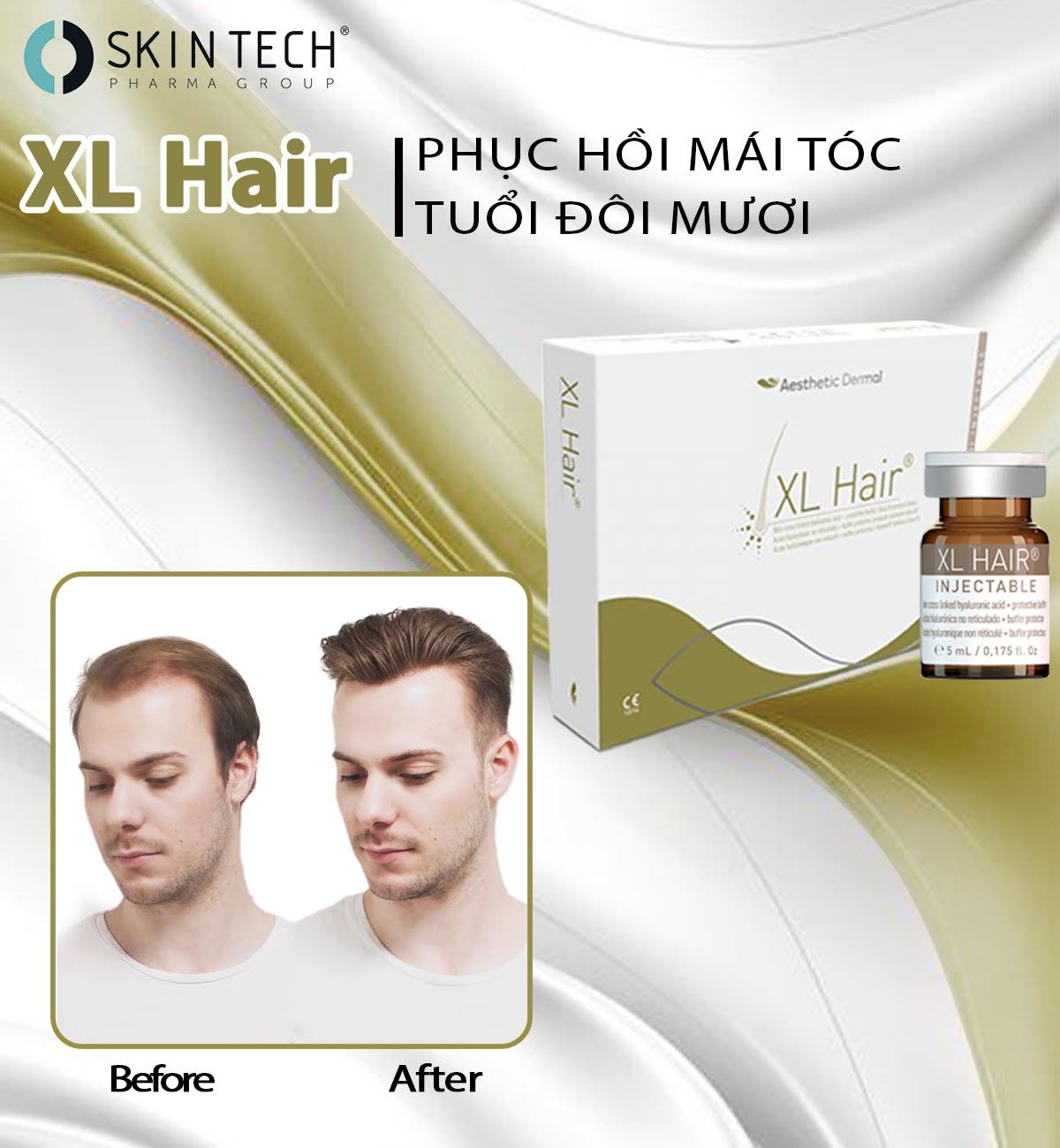 Tinh chất meso kích thích mọc tóc, dưỡng tóc dài khỏe RRS XL Hair SkinTech 5ml