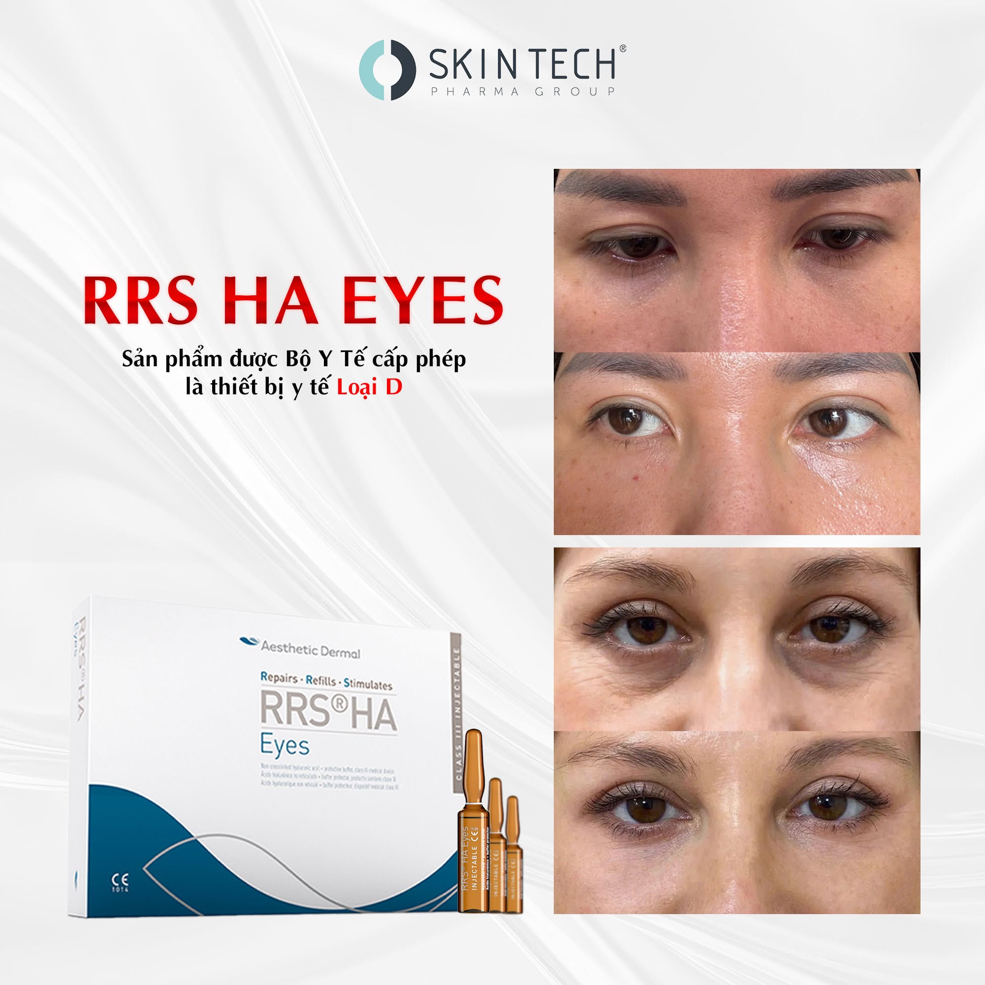 Tinh Chất Meso Hỗ Trợ Cải Thiện Quầng Thâm, Bọng Mắt & Nếp Nhăn SkinTech RRS® HA Eyes 1.5ml Chính Hãng