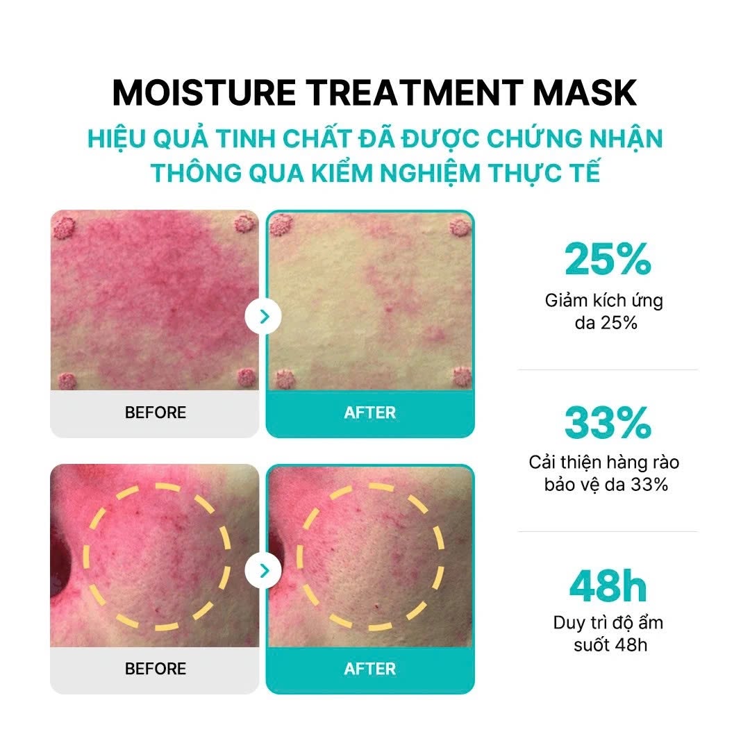 Mặt Nạ DNA Cá Hồi Phục Hồi Và Cấp Ẩm Chuyên Sâu REJURAN Moisture Treatment Mask