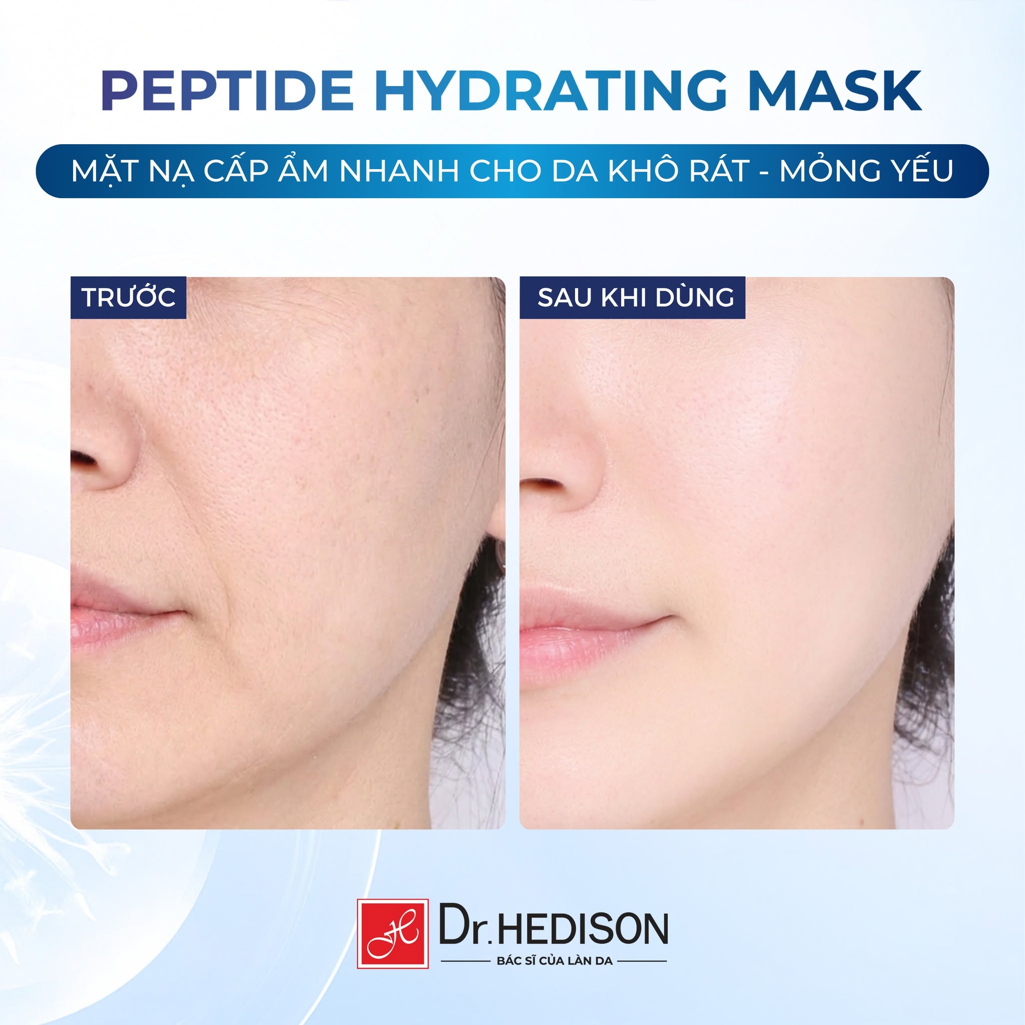 Mặt nạ Cấp ẩm, phục hồi da nhạy cảm Dr.Hedison Peptide Hydrating Mask 23g x 10 miếng