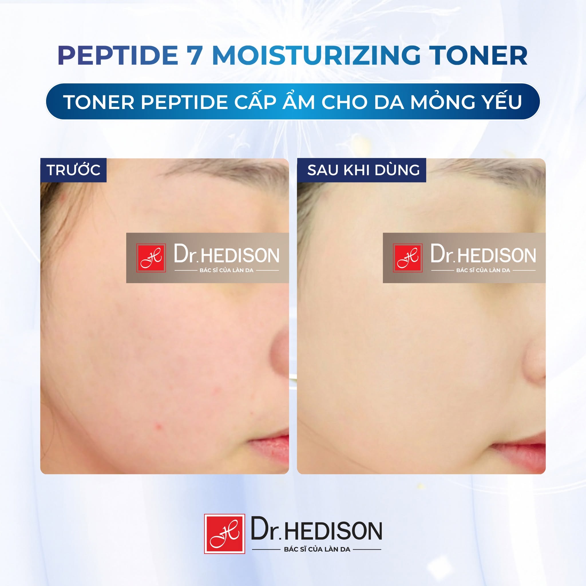 Mặt nạ Cấp ẩm, phục hồi da nhạy cảm Dr.Hedison Peptide Hydrating Mask 23g x 10 miếng