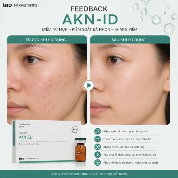 Meso Innoaesthetics AKN-ID Mesotherapy Cho Da Mụn Và Da Dầu Nhờn