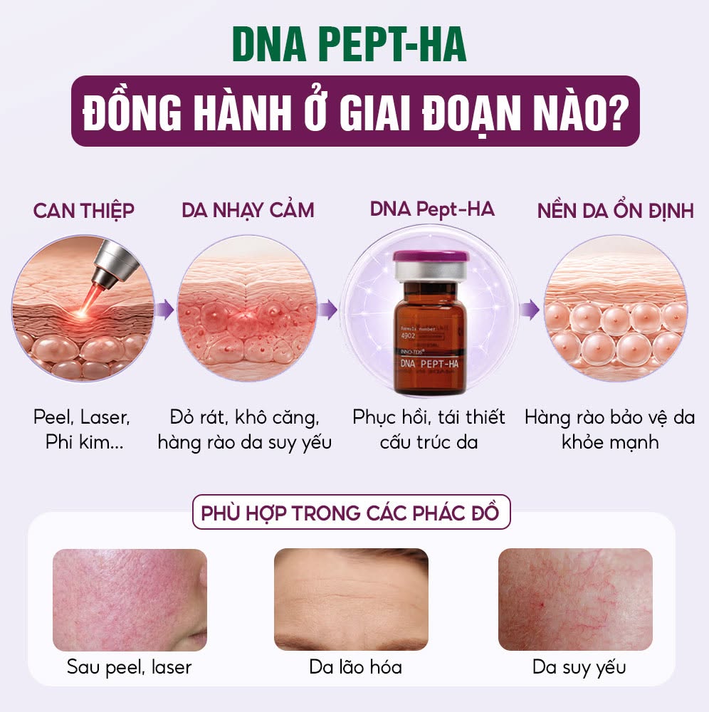 Meso Innoaesthetics DNA PEPT-HA Phục Hồi, Tái Tạo Và Trẻ Hóa Da