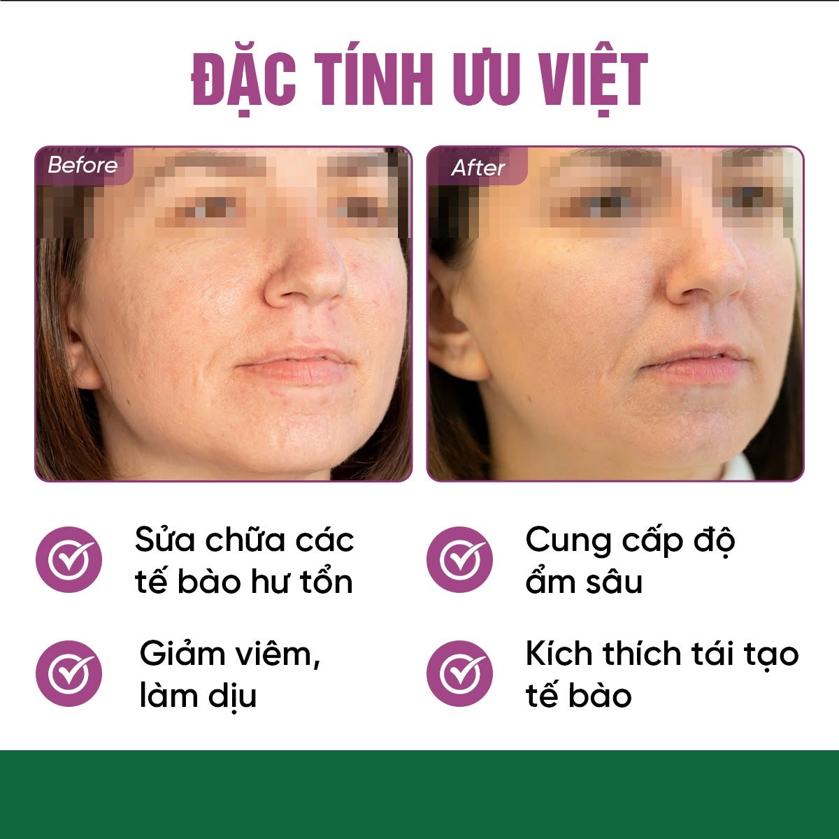Meso Innoaesthetics DNA PEPT-HA Phục Hồi, Tái Tạo Và Trẻ Hóa Da