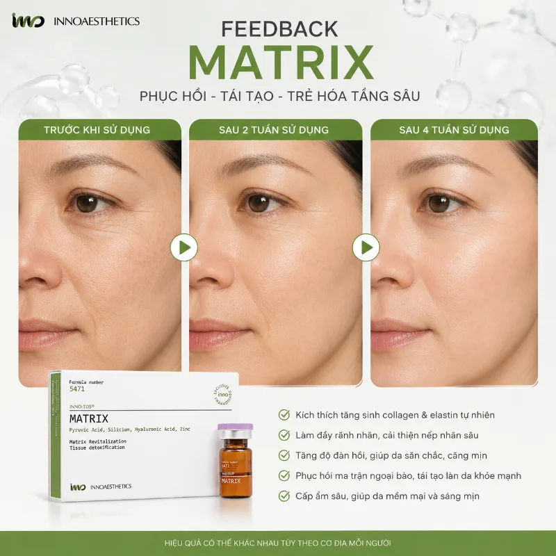 Meso Innoaesthetics MATRIX Trẻ Hóa, Tái Cấu Trúc Da Chuyên Sâu