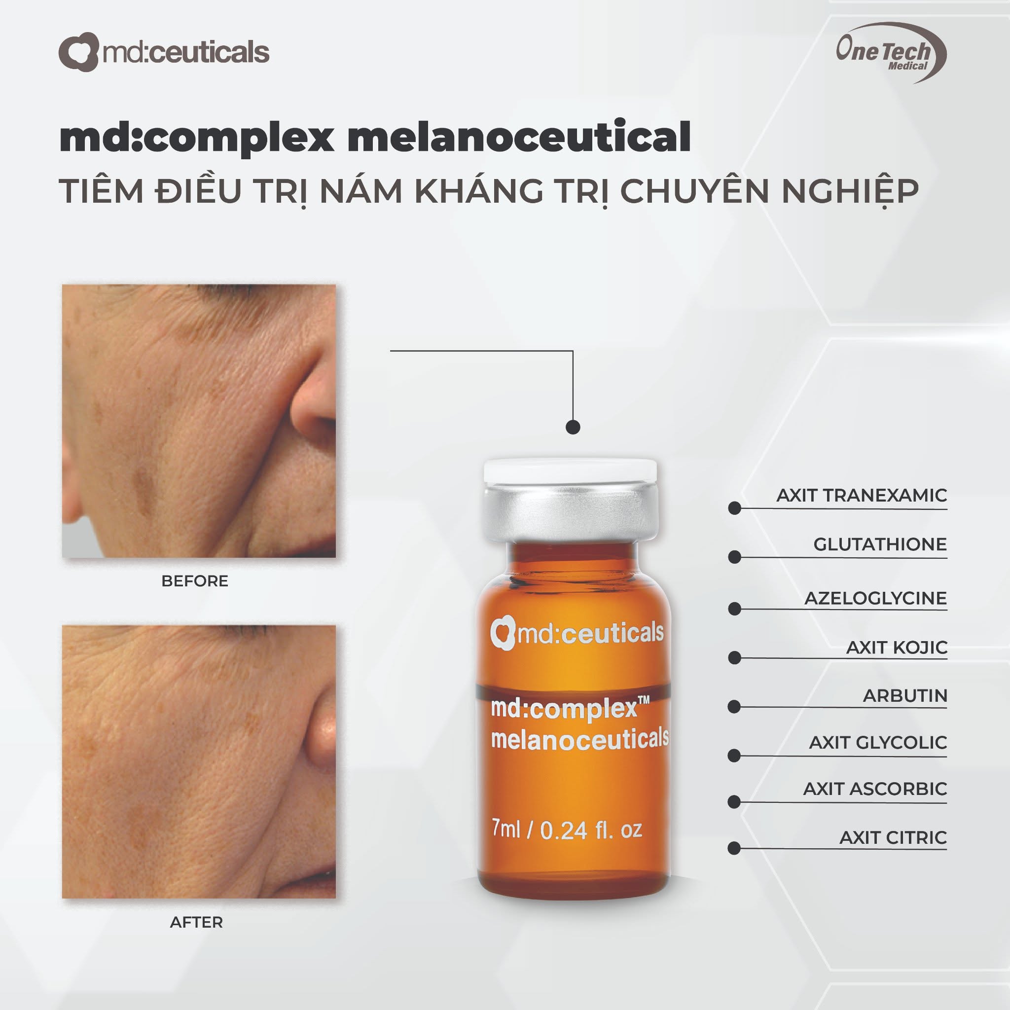 Meso mờ nám, đốm nâu và tăng sắc tố da Md:Complex Melanoceuticals md:ceuticals 7ml