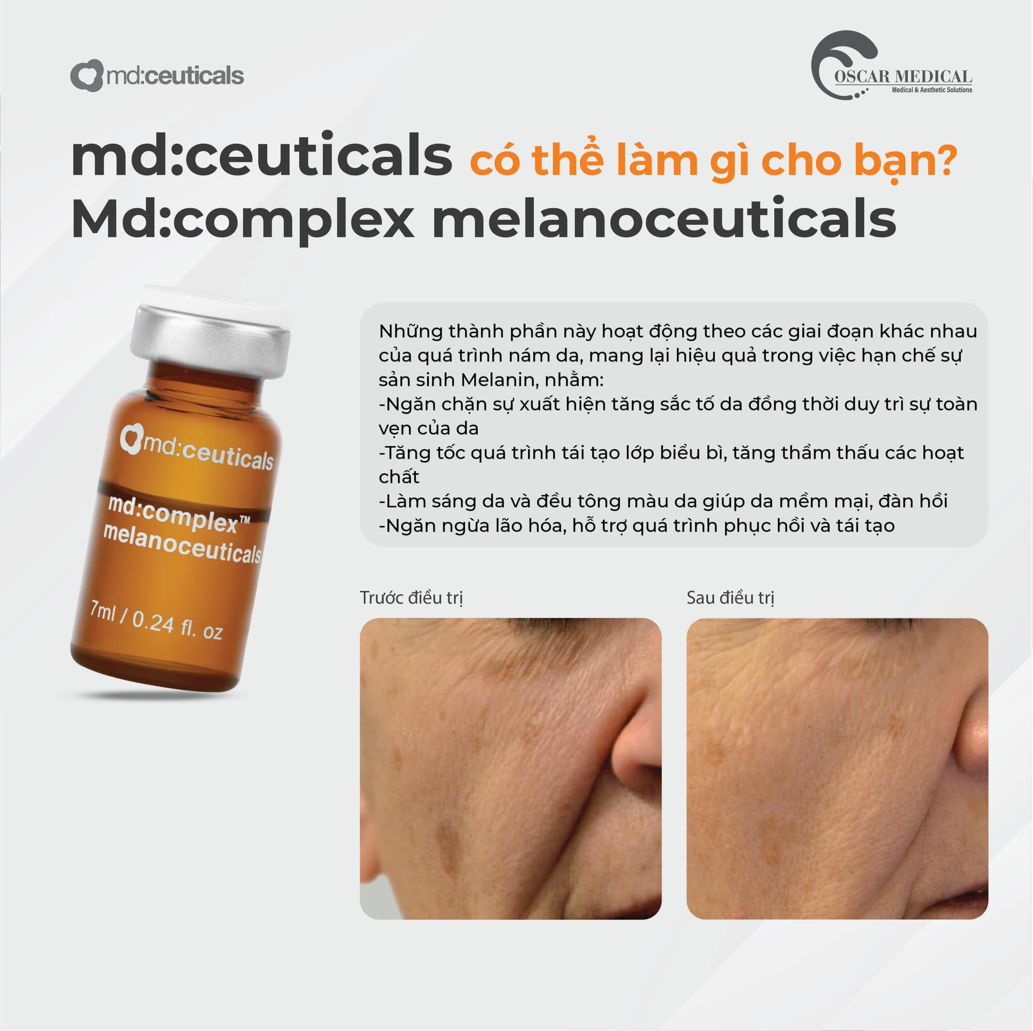 Meso mờ nám, đốm nâu và tăng sắc tố da Md:Complex Melanoceuticals md:ceuticals 7ml