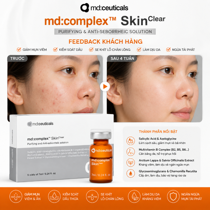 Meso ức chế mụn Md:Ceuticals Md:Complex Skinclear Cx