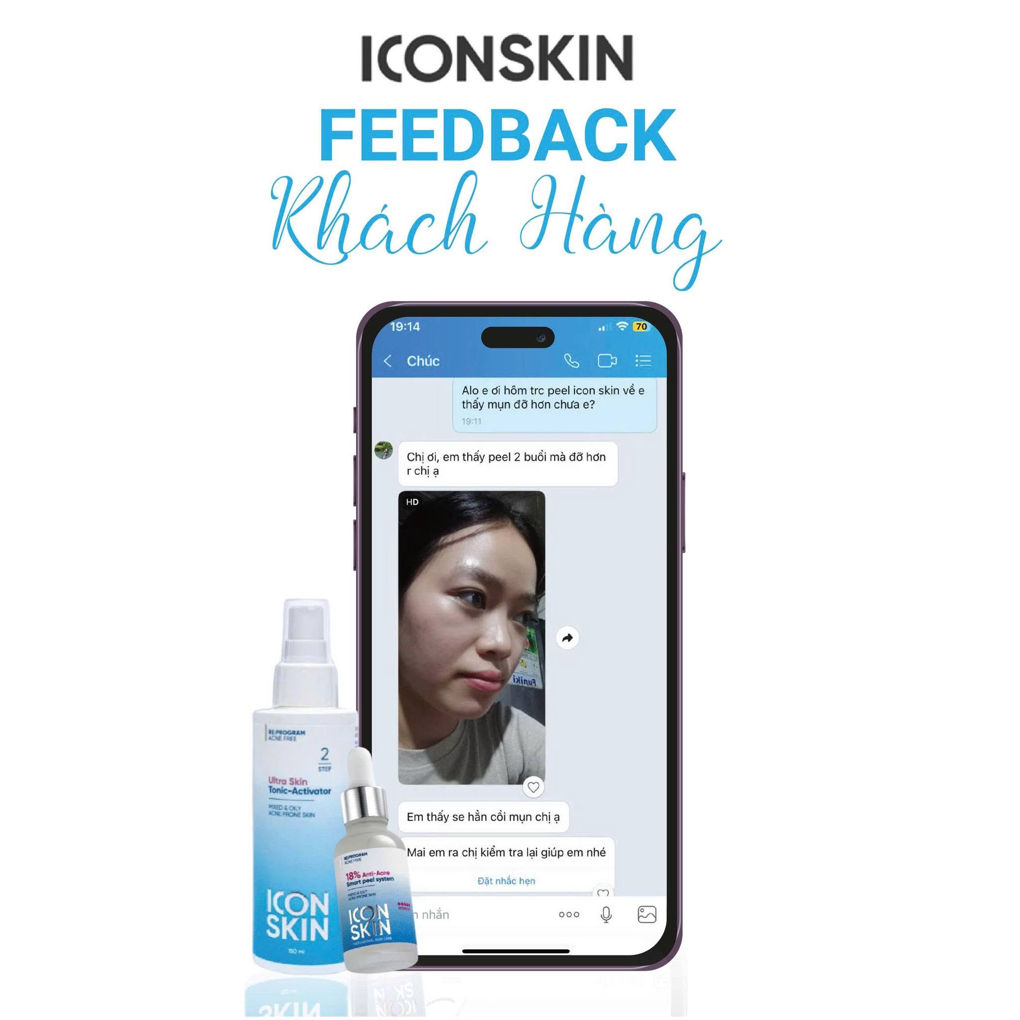 Nước cân bằng cho da dầu, da hỗn hợp Icon Skin Ultra Skin Tonic-Activator