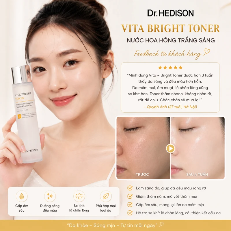 Nước hoa hồng cấp ẩm, làm dịu & dưỡng sáng da Dr.HEDISON Vita Bright Toner 150ml-500ml