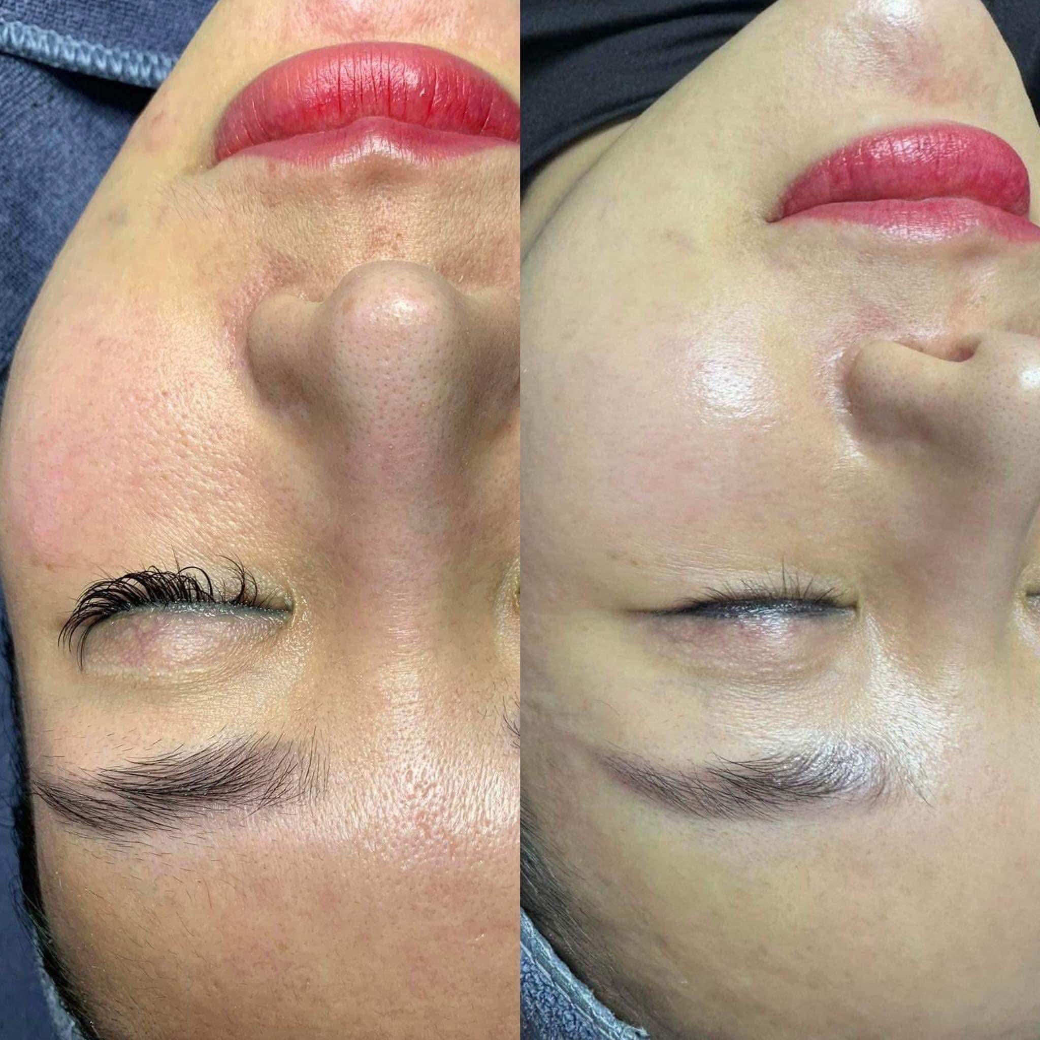 PEEL INNOAESTHETICS T.C.AGE HOẠT CHẤT TÁI TẠO, THAY MỚI LÀN DA DÀNH CHO DA CÓ SẸO RỖ, RẠN DA 1 LOJ 5ML
