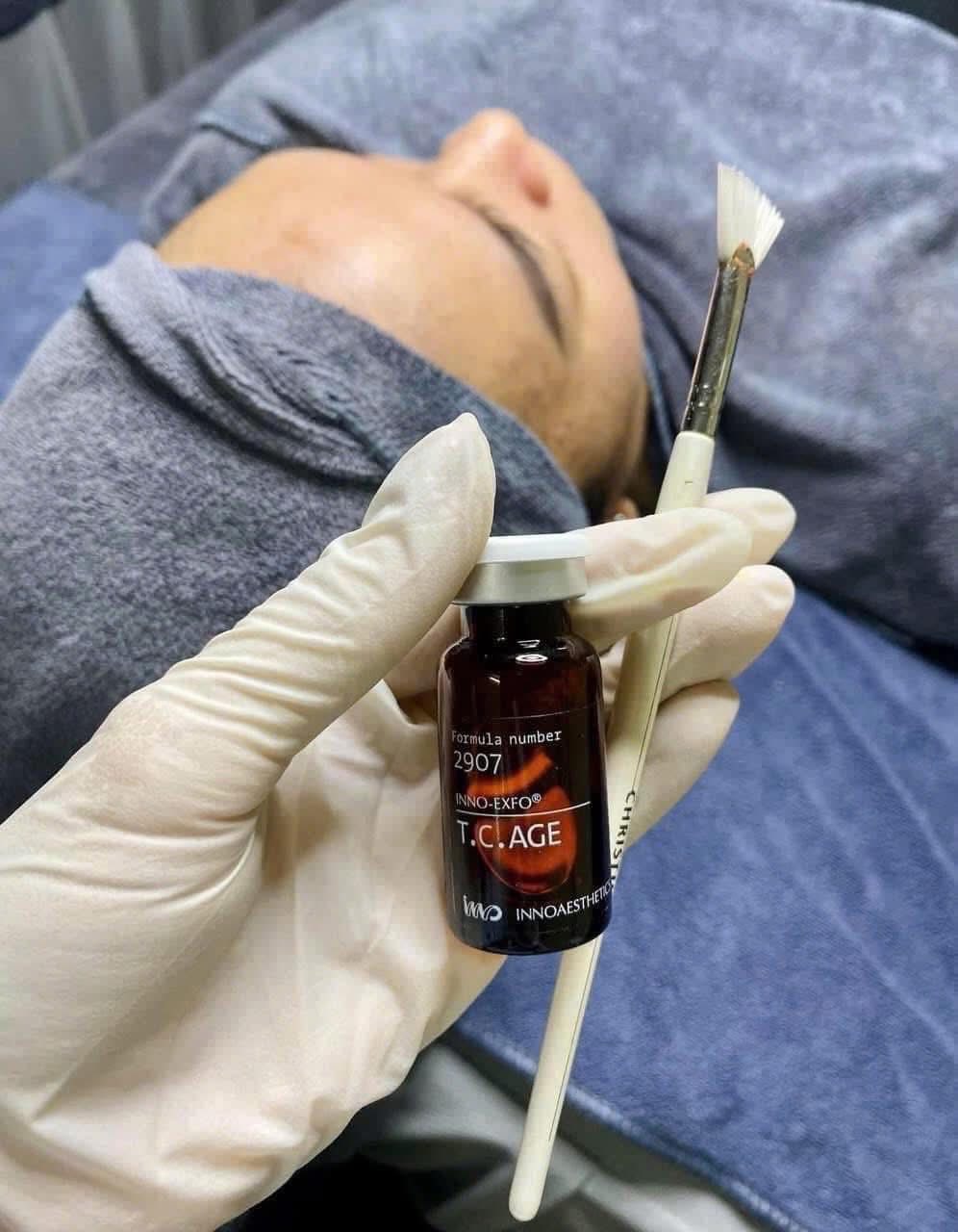 PEEL INNOAESTHETICS T.C.AGE HOẠT CHẤT TÁI TẠO, THAY MỚI LÀN DA DÀNH CHO DA CÓ SẸO RỖ, RẠN DA 1 LOJ 5ML