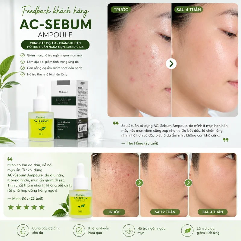 Serum MEDIWORLD AC - SEBUM AMPOULE | Hỗ Trợ Giảm Mụn, Kiểm Soát Dầu & Làm Dịu Da Hiệu Quả