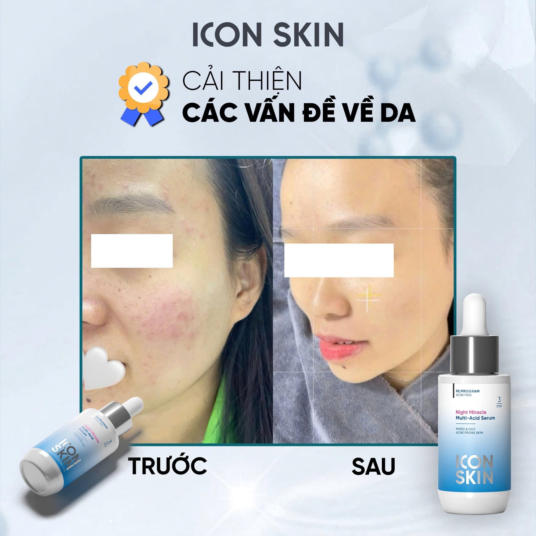 Serum ban đêm cho da dầu, da hỗn hợp Icon Skin Night Miracle Multi-Acid Serum