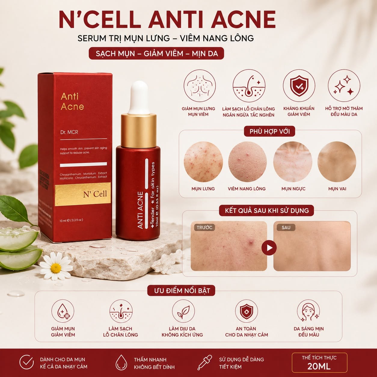 Serum Hỗ Trợ Giảm Mụn Lưng, Viêm Nang Lông N'Cell Anti Acne Serum 20ml
