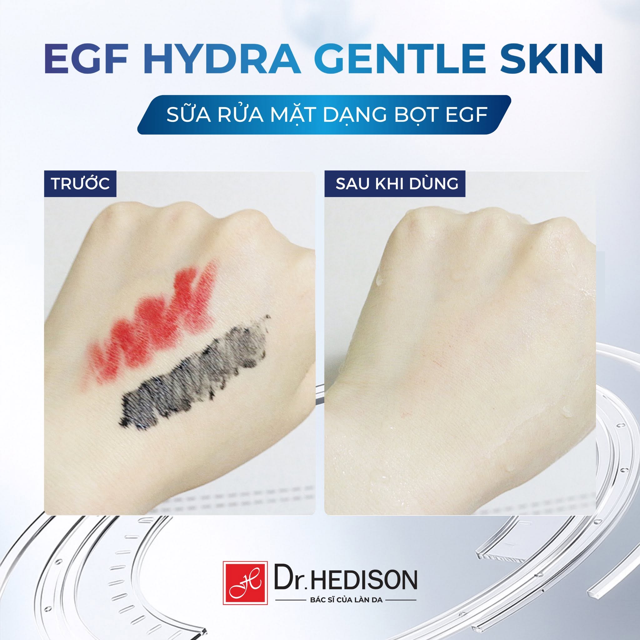 Sữa Rửa Mặt Dạng Bọt Tái Tạo Da Dr.Hedison EGF Limpid Foam Cleanser 180ml Chính Hãng Hàn Quốc