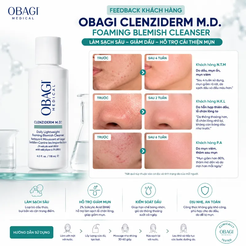 Sữa Rửa Mặt Làm Sạch Sâu, Giảm Dầu Thừa Obagi CLENZIderm M.D. Foaming Blemish 118ml