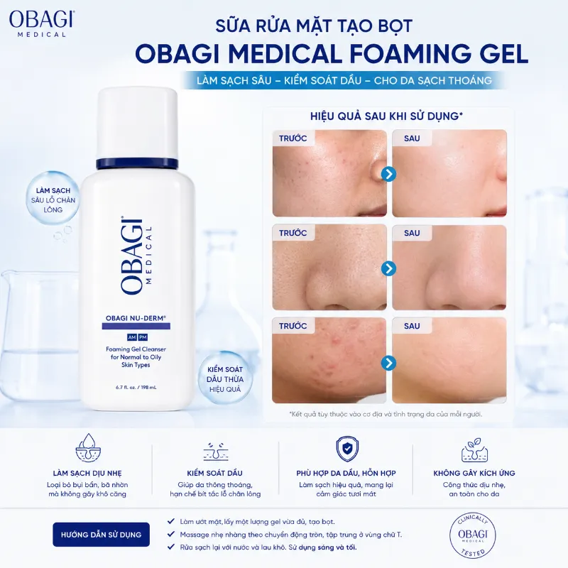 Sữa Rửa Mặt Tạo Bọt Làm Sạch Da Dầu, Da Hỗn Hợp Obagi Nu-Derm Foaming Gel 200ml Chính Hãng
