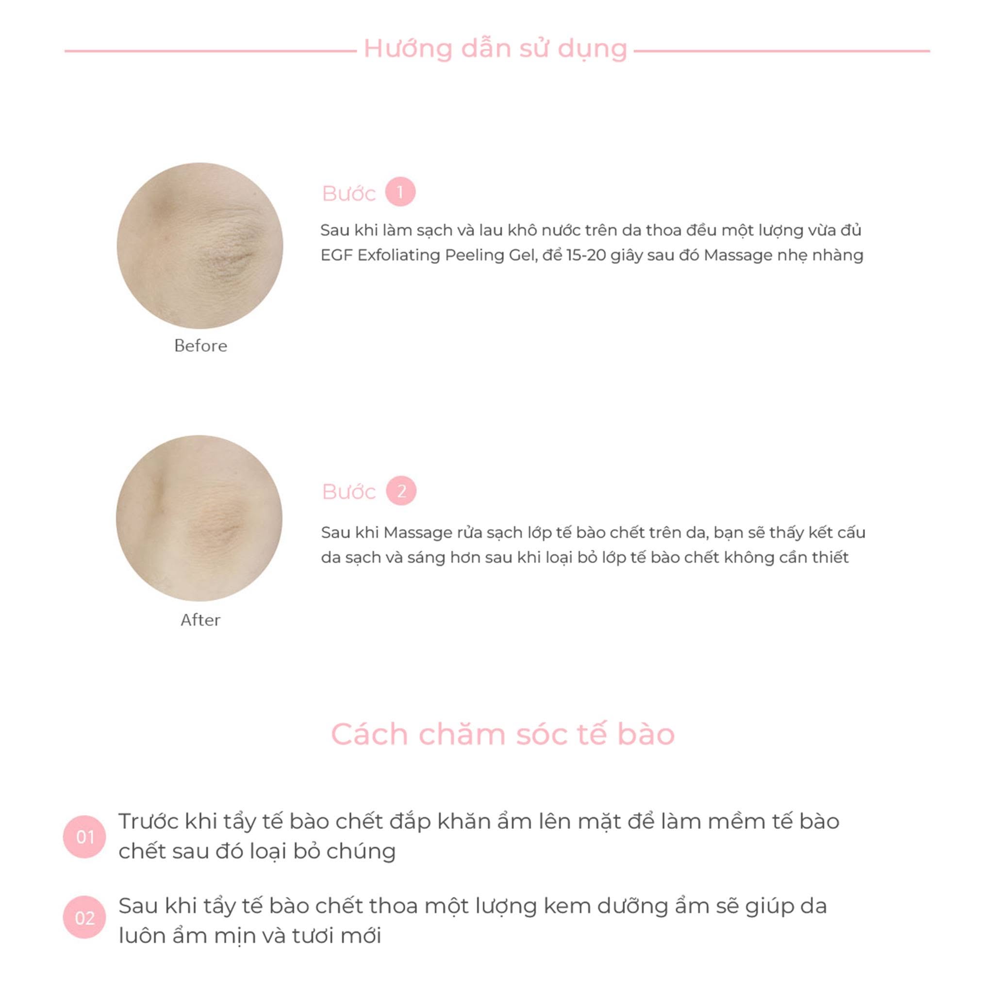 Tẩy da chết vật lý EGF Exfoliating Peeling Gel Dr.Hedison 170ml