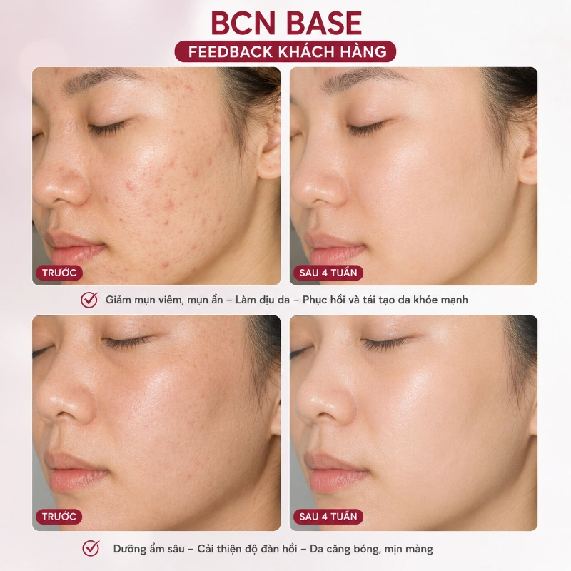 Tinh Chất BCN Base Institute BCN – Cocktail Dưỡng Chất Cơ Bản, Tái Tạo & Phục Hồi Da