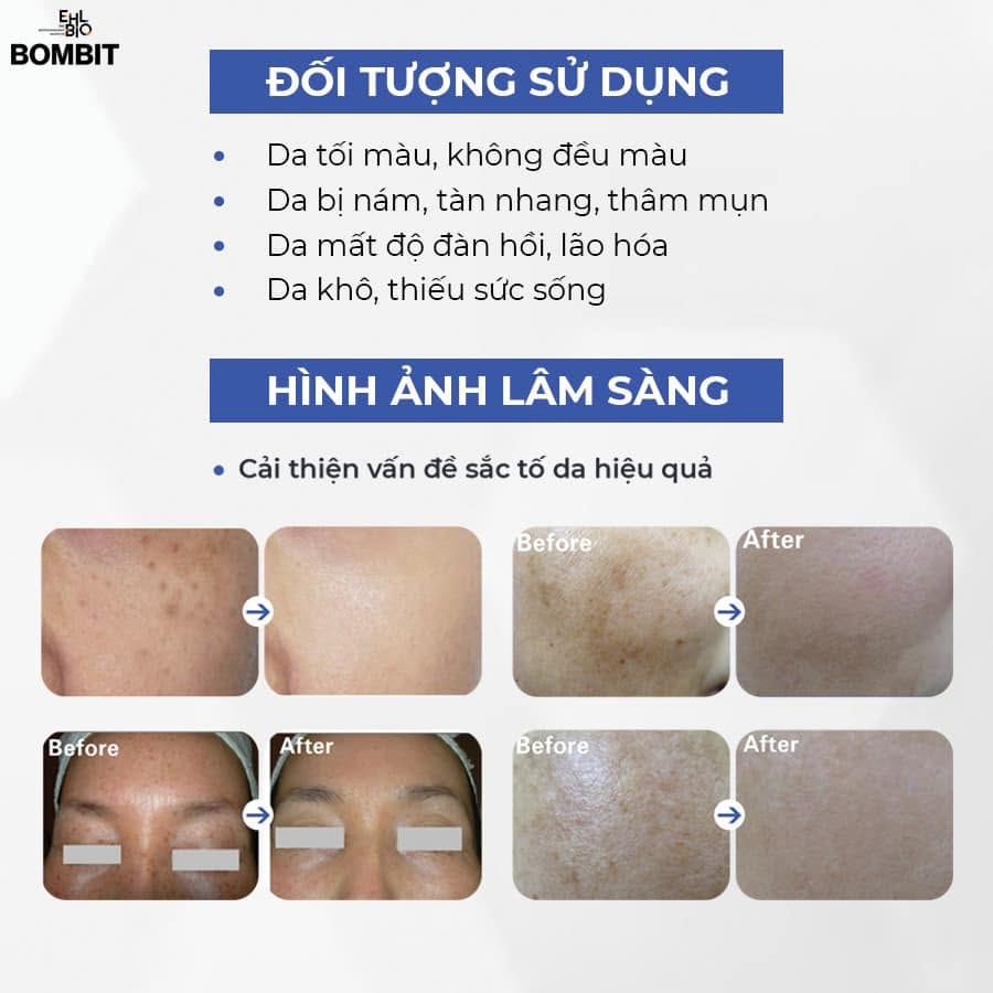 Tinh Chất Hỗ Trợ Điều Trị Nám, Sạm Và Làm Sáng Da BOMBIT Snow Meso