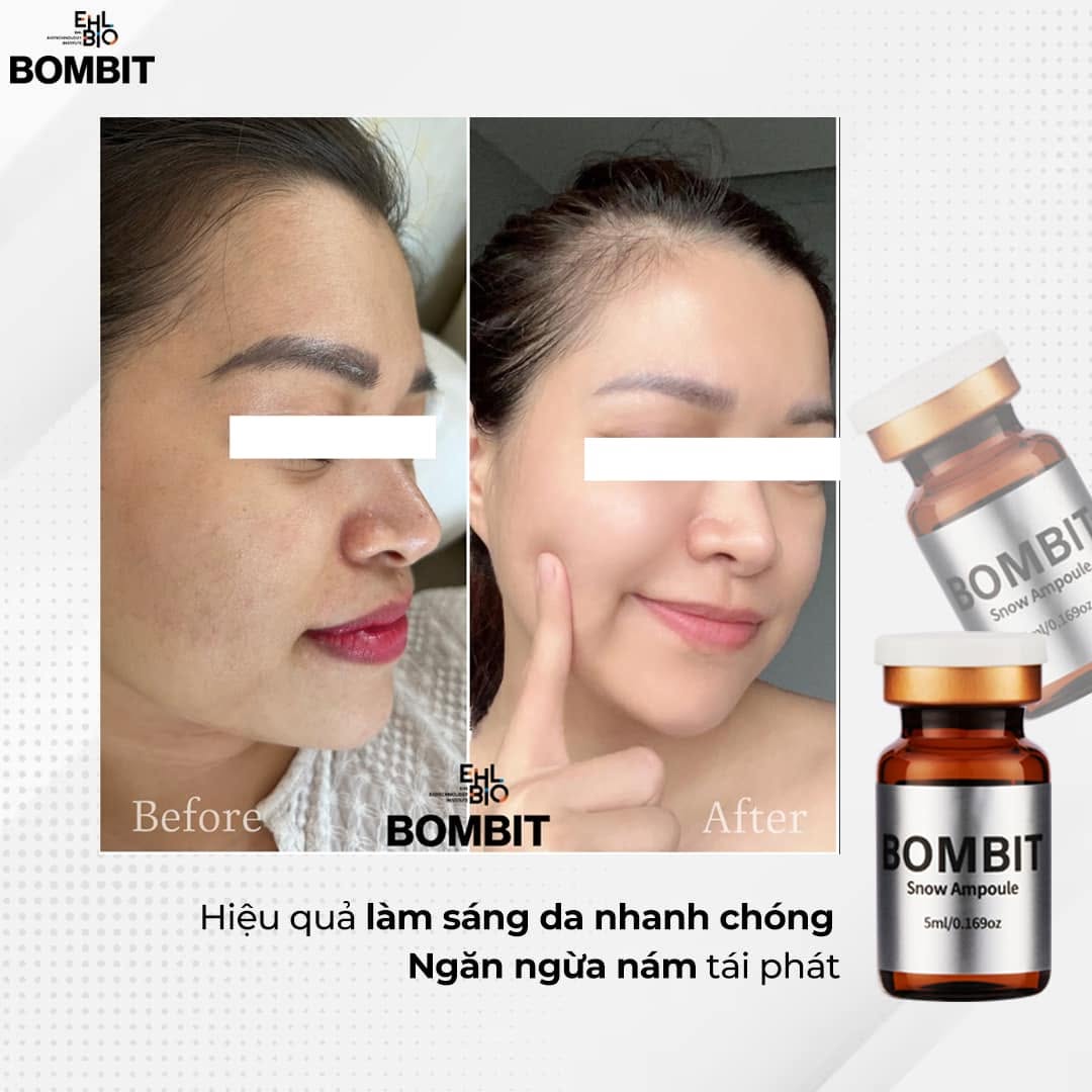 Tinh Chất Hỗ Trợ Điều Trị Nám, Sạm Và Làm Sáng Da BOMBIT Snow Meso