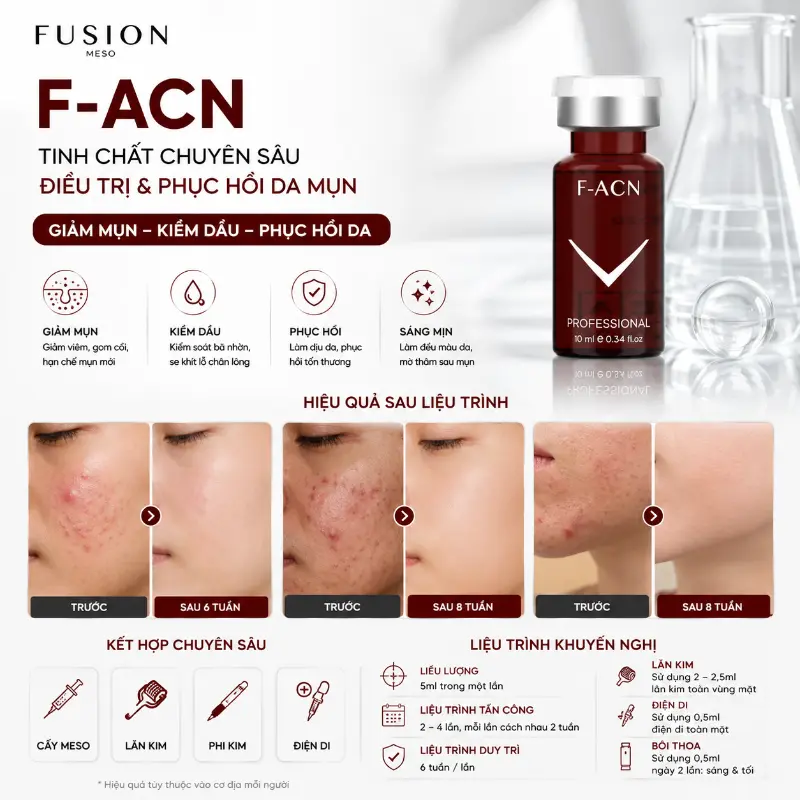 Tinh Chất Meso Hỗ Trợ Giảm Mụn, Cải Thiện Thâm & Kiểm Soát Dầu Nhờn Fusion Mesotherapy F-ACN 10ml Chính Hãngm Và Kiểm Soát Dầu Nhờn