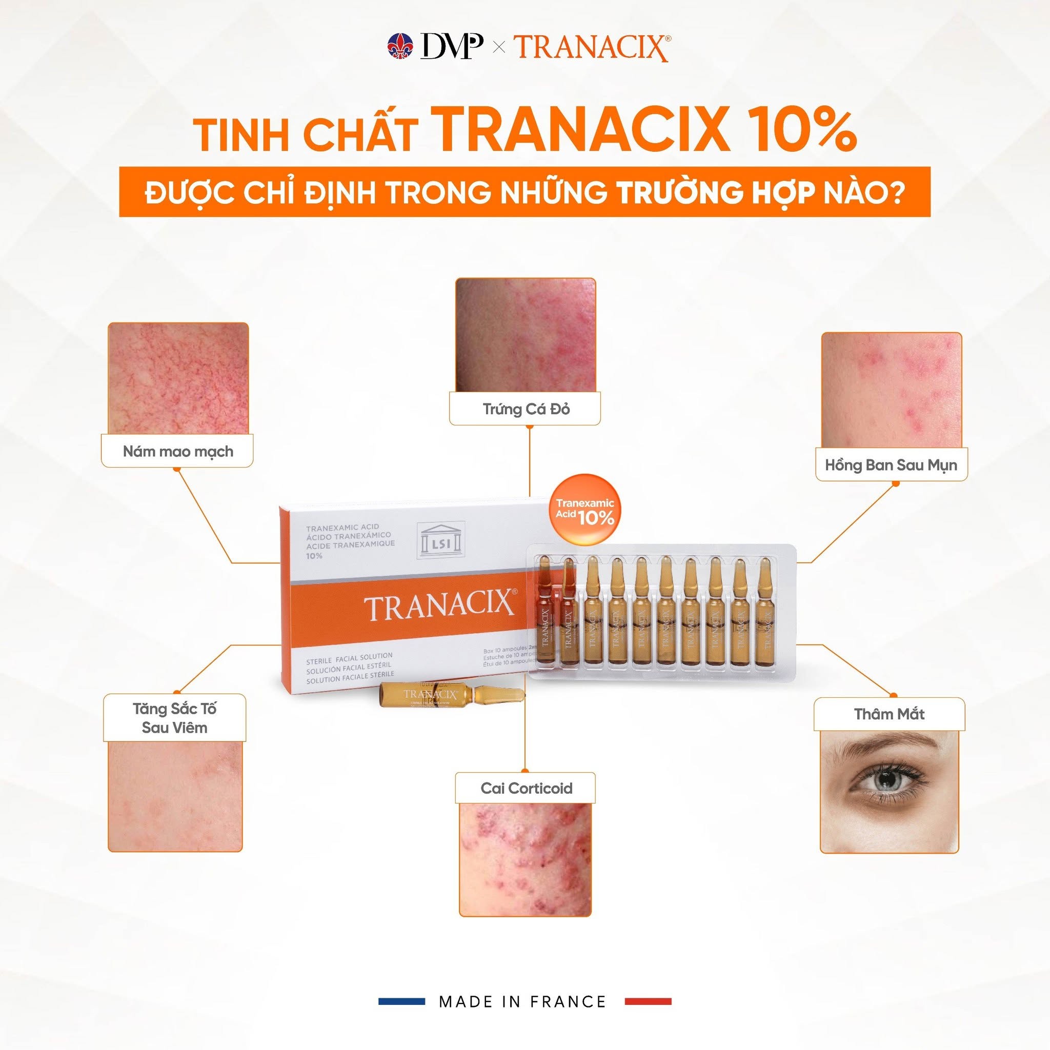 Tinh Chất TRANACIX 10% TRANACIX® Sterile Facial Solution - Hỗ Trợ Làm Mờ Nám Và Sắc Tố Chuyên Sâu Lẻ 1 Ống