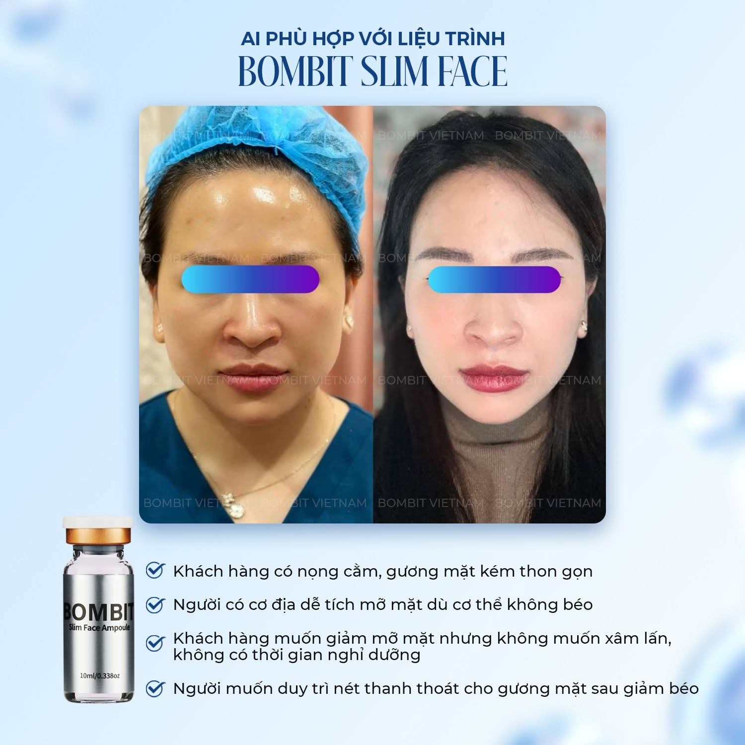 Tinh Chất Thon Gọn Mặt, Hỗ Trợ Giảm Mỡ Má Và Nọng Cằm BOMBIT Slim Face
