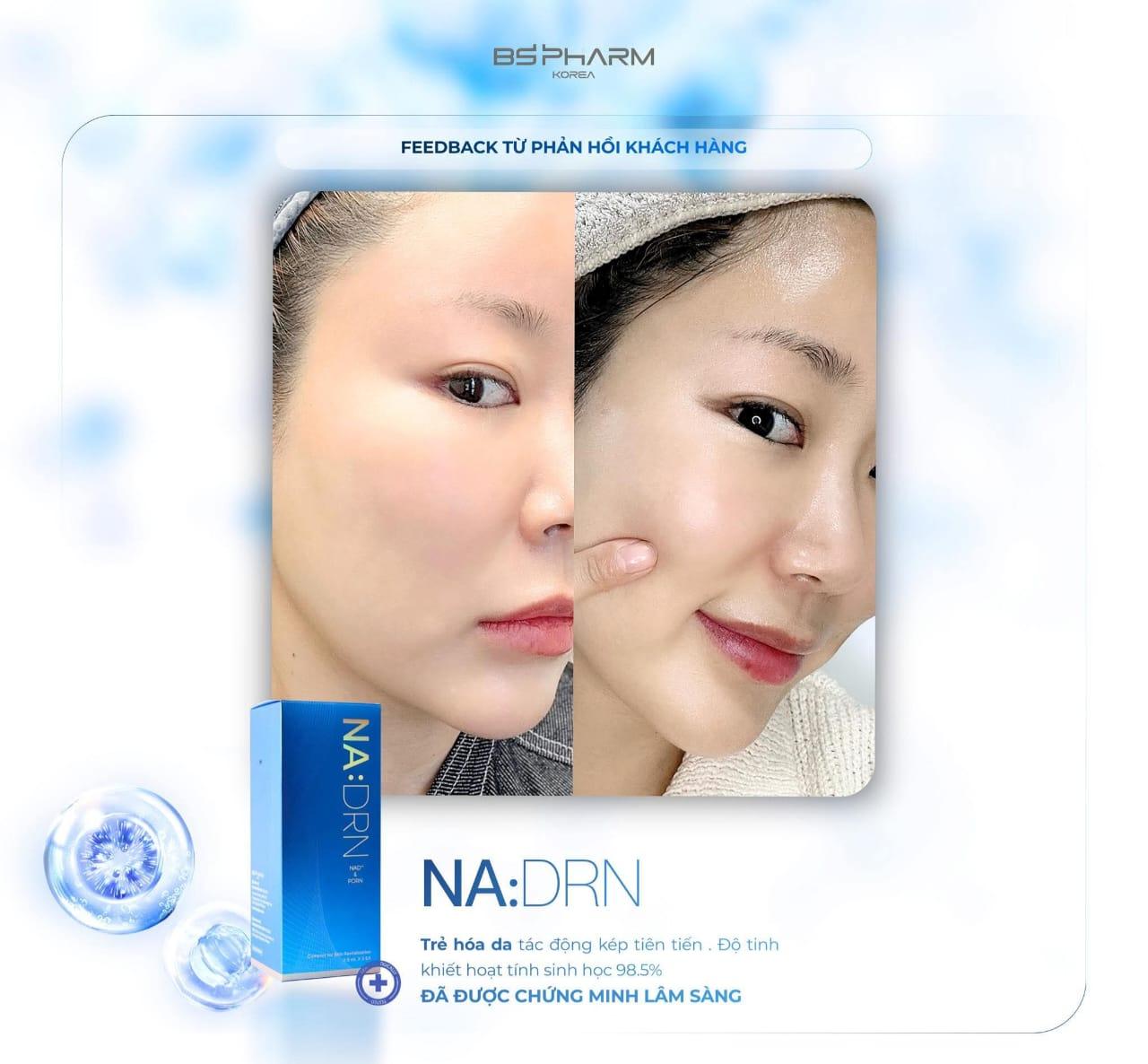 Tinh Chất Tiêm Trẻ Hóa NA:DRN: Chuẩn Mực Tái Tạo Da Sinh Học Từ NAD+ & PDRN