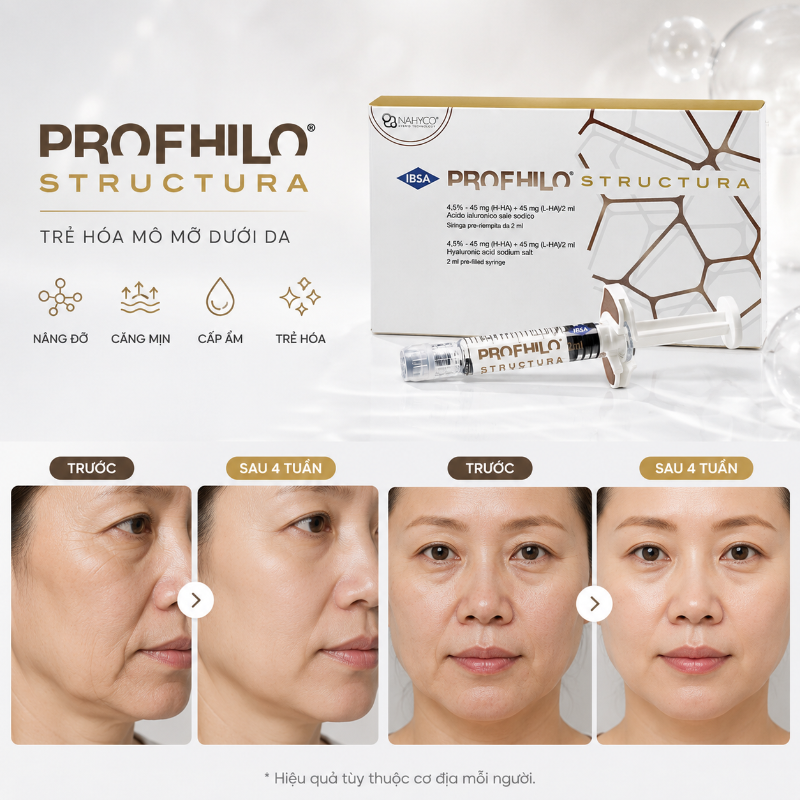 Tinh Chất Tiêm Trẻ Hóa, Tái Tạo Mô Và Cải Thiện Da Chùng Profhilo® Structura