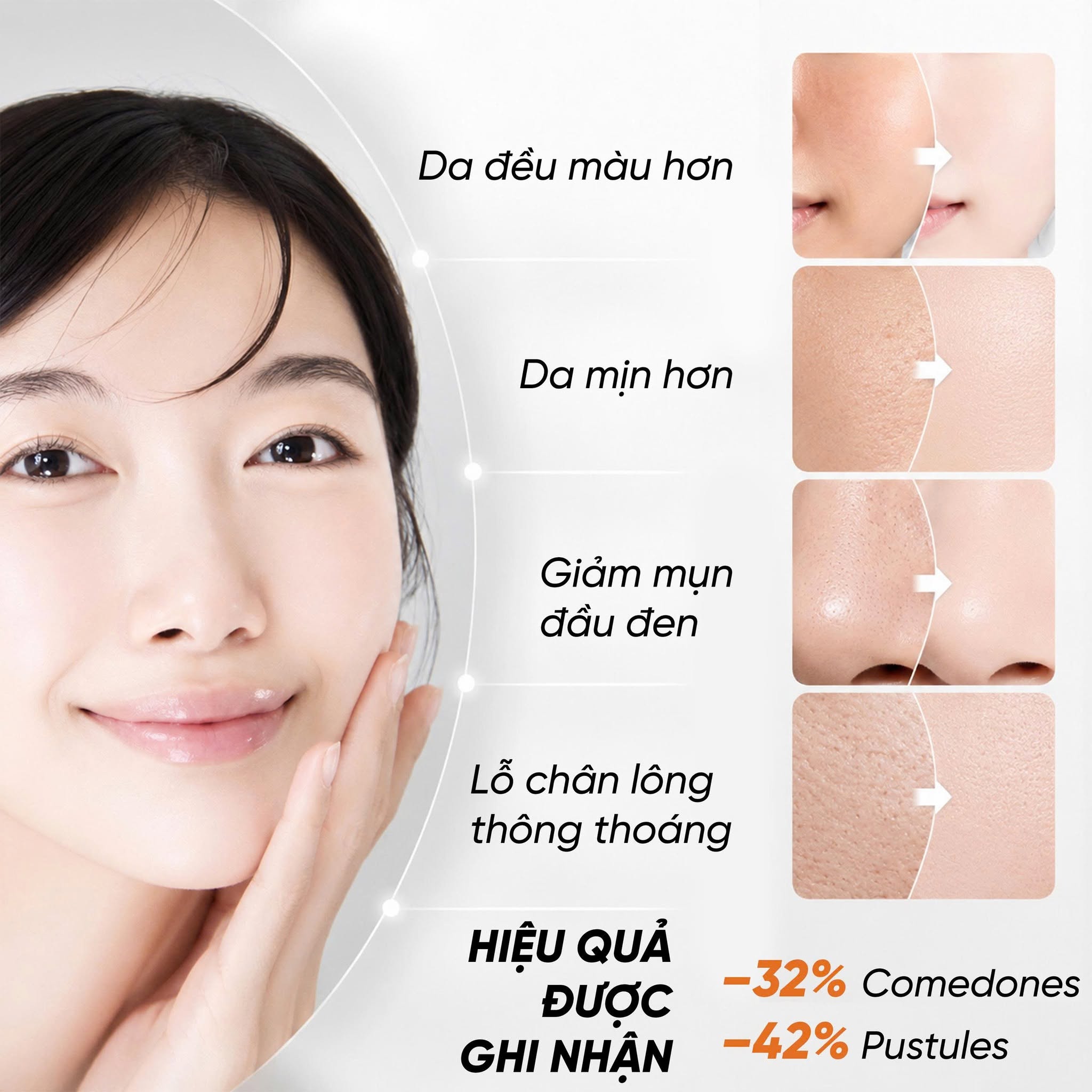 Tinh chất AHA căng bóng da Icon Skin 12% Mandelic Peel System