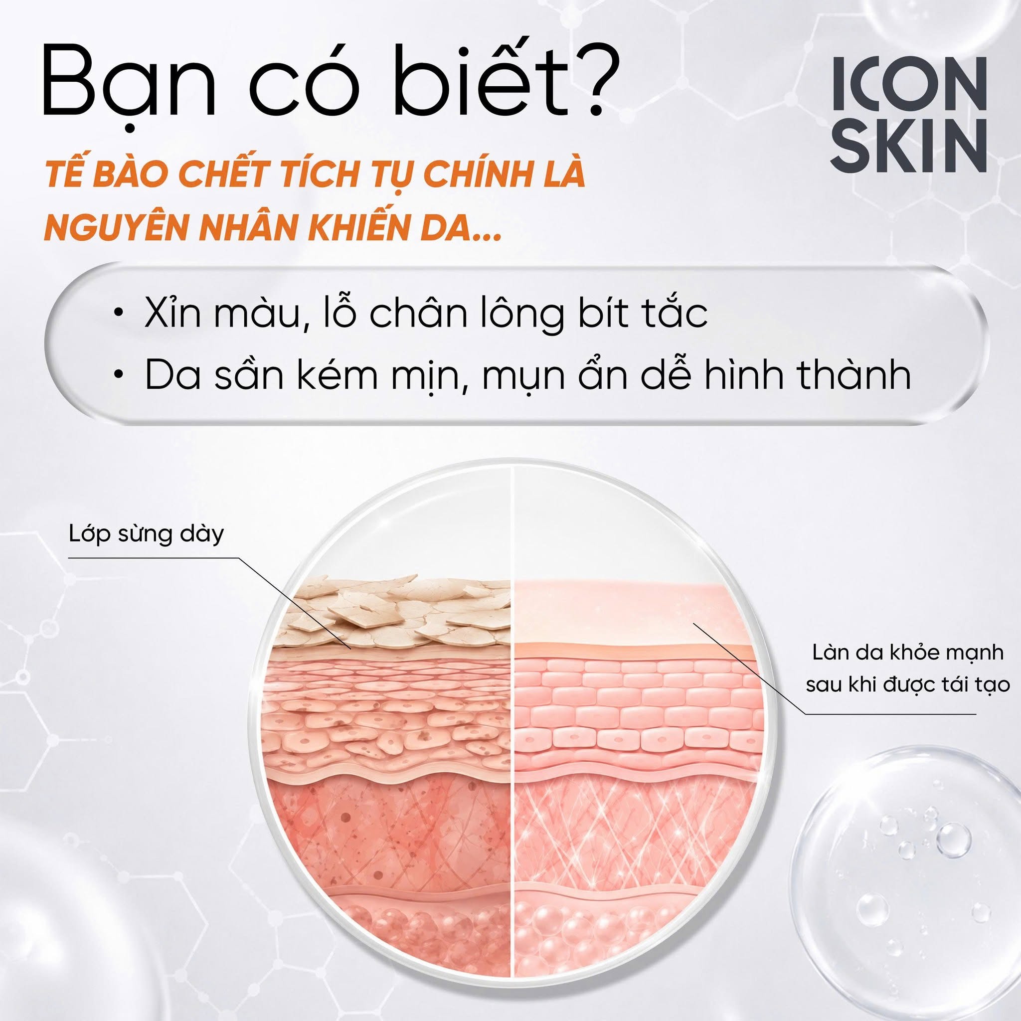 Tinh chất AHA căng bóng da Icon Skin 12% Mandelic Peel System