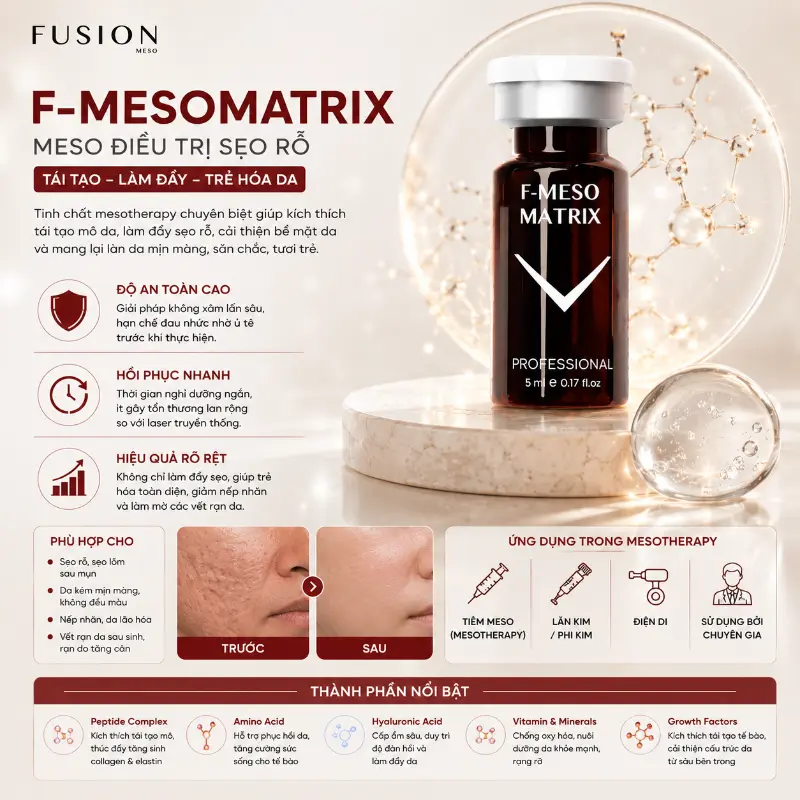 Tinh Chất Hỗ Trợ Cải Thiện Sẹo Lõm, Sẹo Rỗ Fusion F-Meso Matrix 5ml Chính Hãng