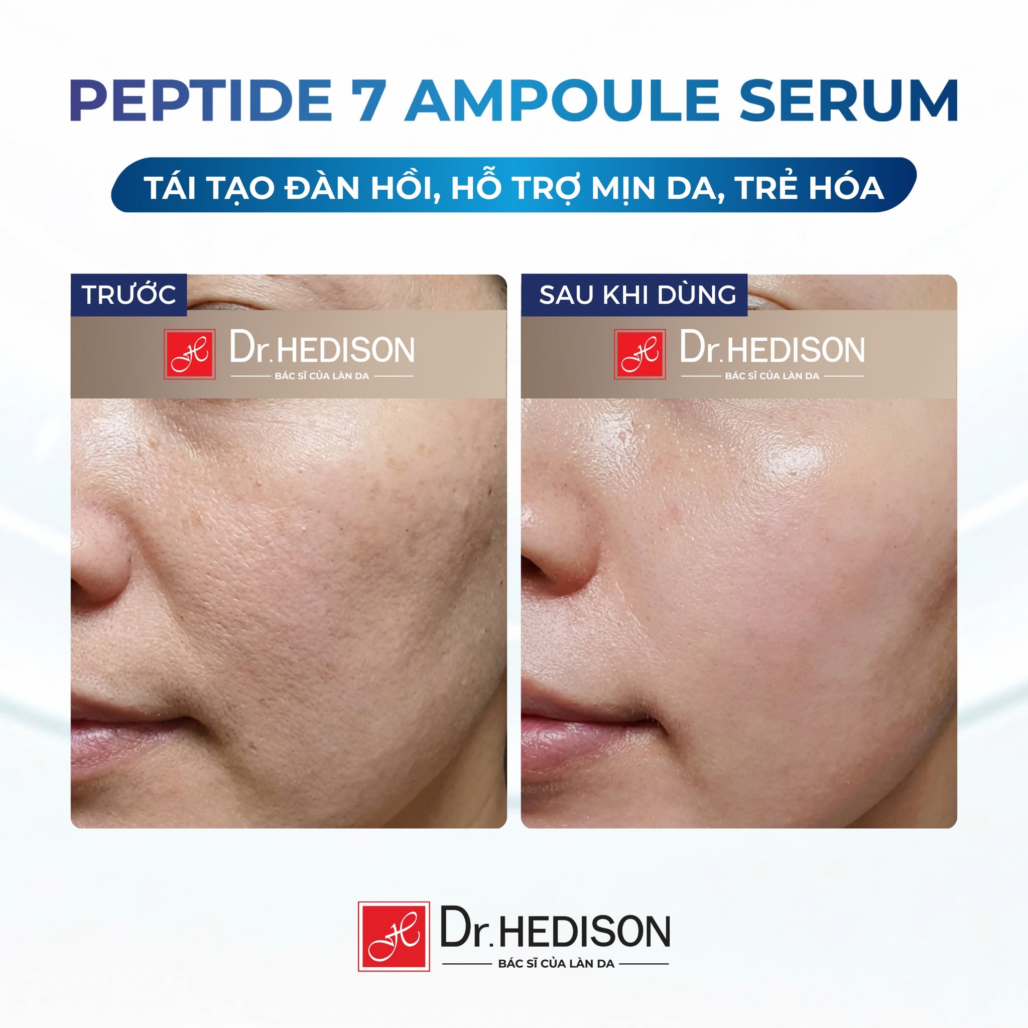 Tinh Chất Peptide 7 Ampoule Serum Dr.HEDISON 50ml-250ml | Giảm Nhăn, Tăng Đàn Hồi Da