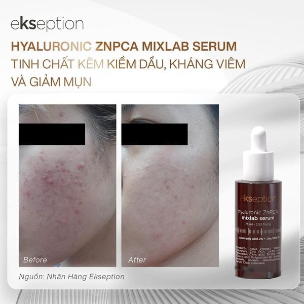 Tinh chất hỗ trợ giảm mụn và giảm dầu thừa trên da EKSEPTION HYALURONIC ZNPCA MIXLAB SERUM
