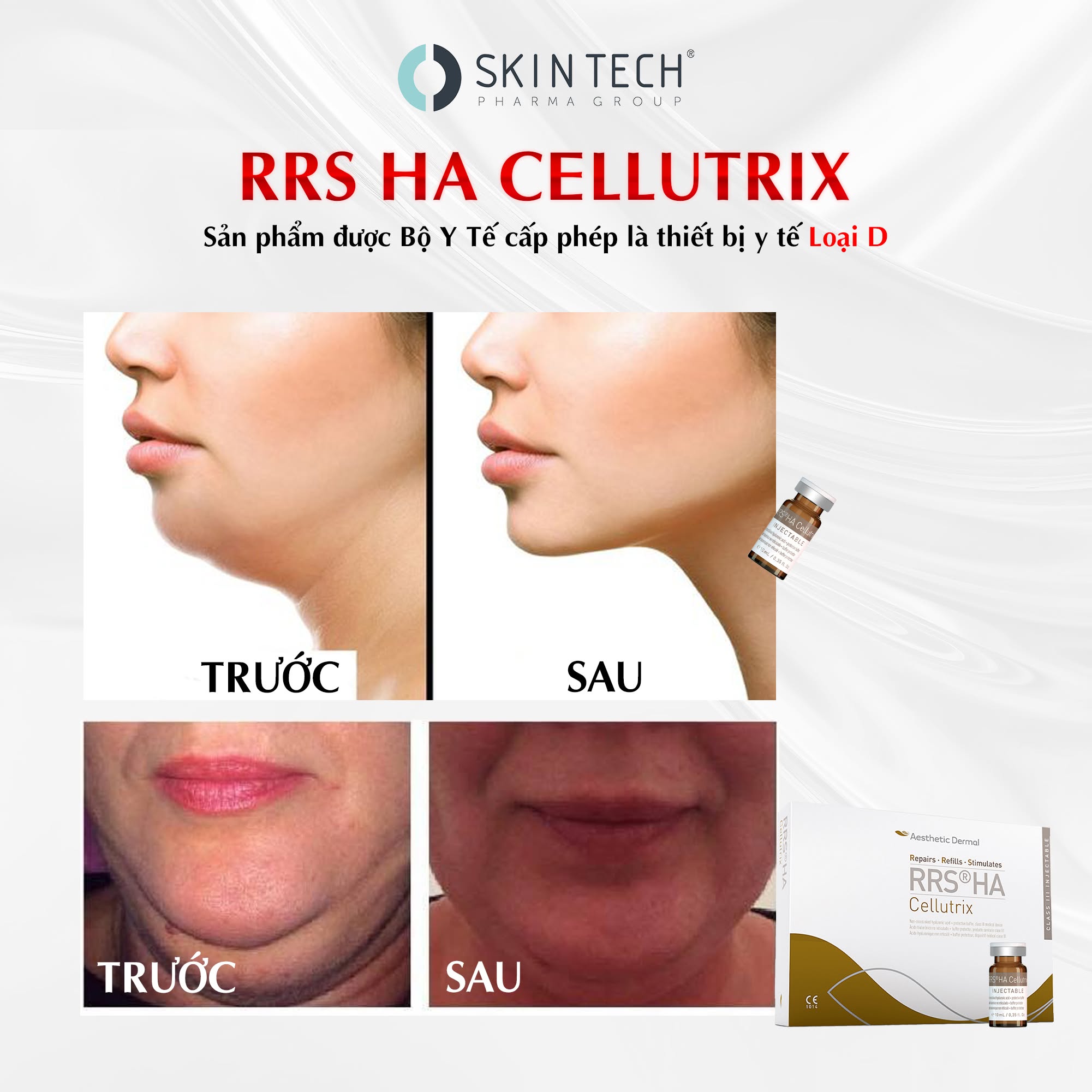 Tinh chất meso giảm mỡ thon gọn cơ thể RRS® HA Cellutrix Skintech 10ml