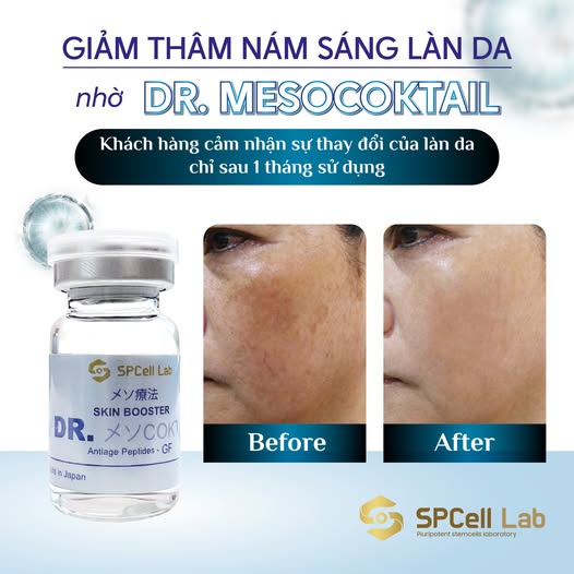 Tinh chất phục hồi, giảm thâm nám và trẻ hóa da SP Cell Lab Skin Booster DR. Meso Coktail