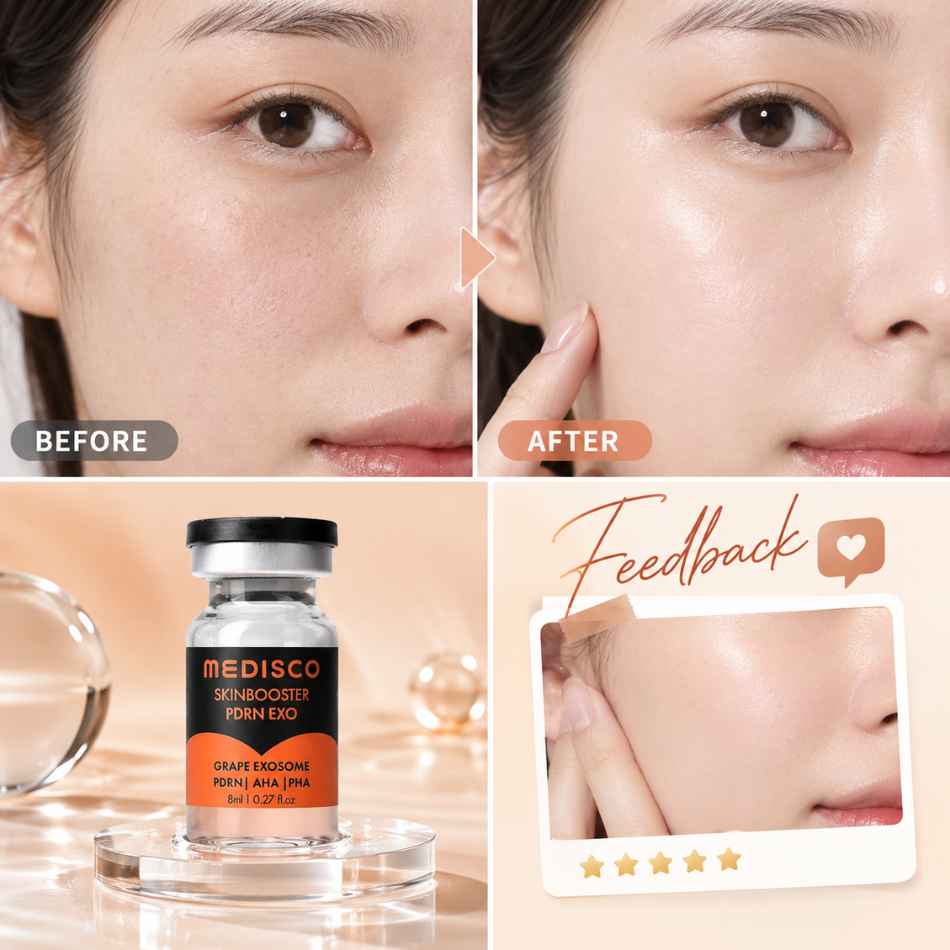 Tinh chất tái tạo, trẻ hóa củng cố hàng rào bảo vệ da Medisco SkinBooster PDRN EXO