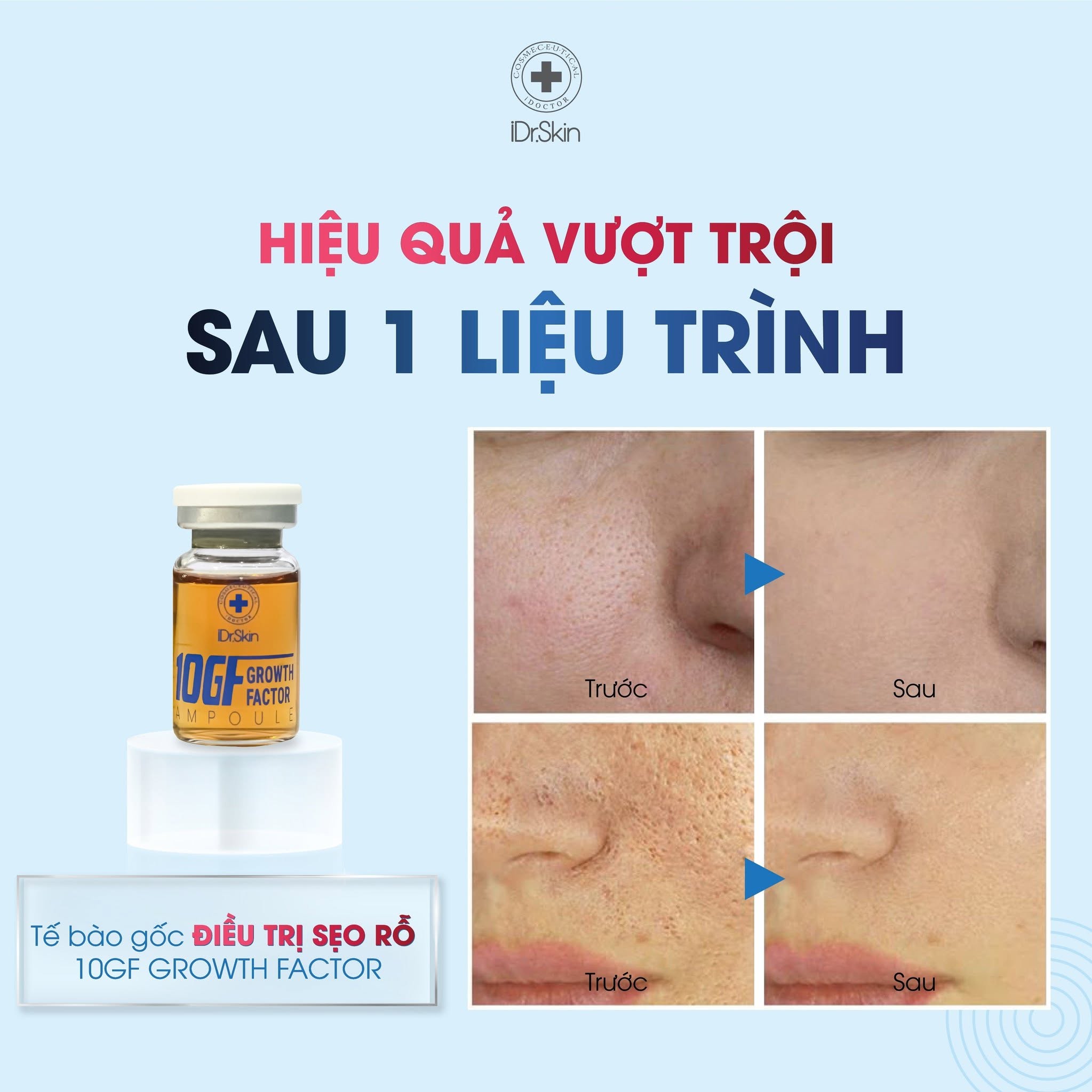 Tinh Chất Tế Bào Gốc Hỗ Trợ Cải Thiện Sẹo Rỗ Idr.Skin 10GF Growth Factor 10ml Chính Hãng