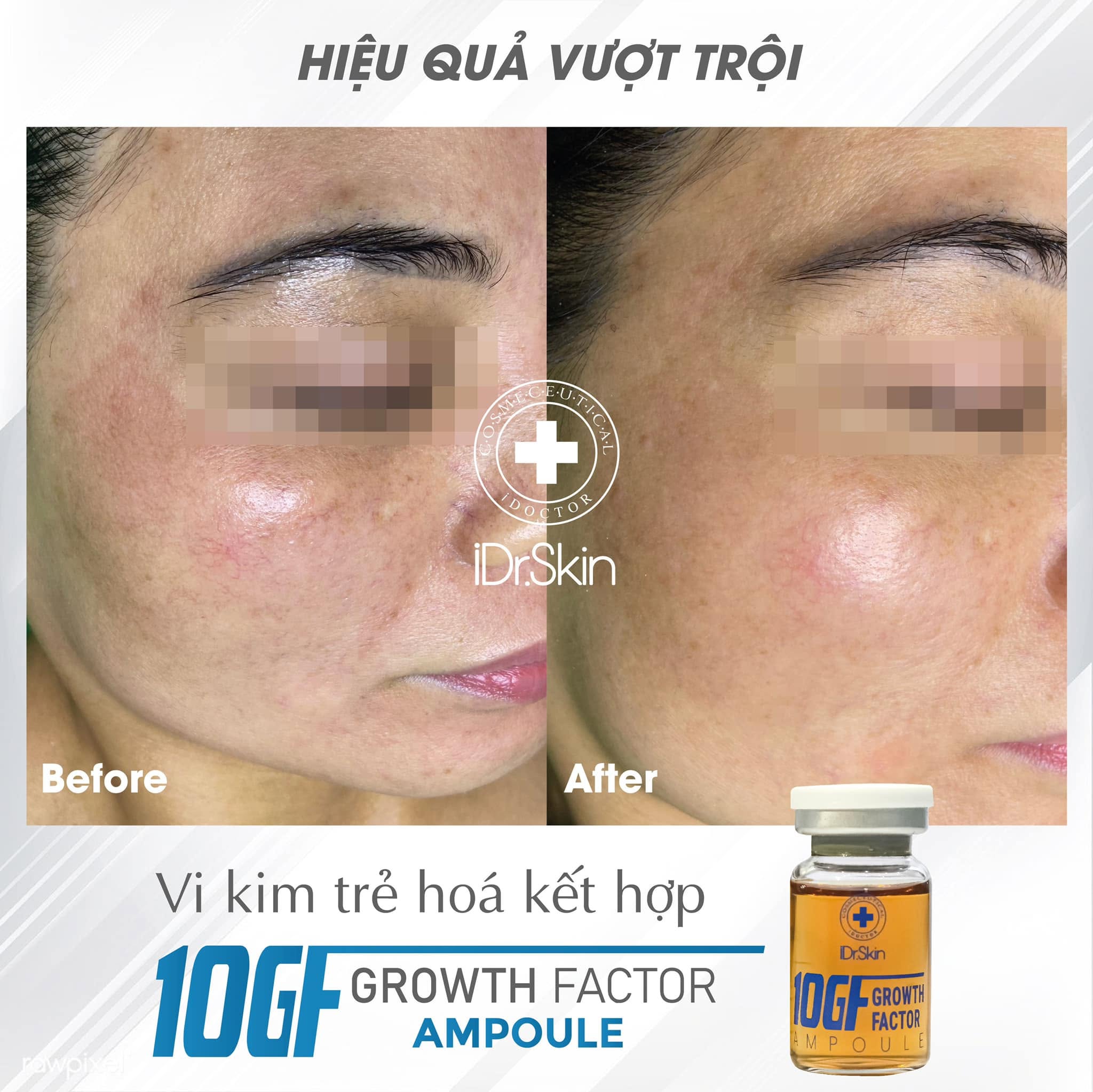 Tinh Chất Tế Bào Gốc Hỗ Trợ Cải Thiện Sẹo Rỗ Idr.Skin 10GF Growth Factor 10ml Chính Hãng