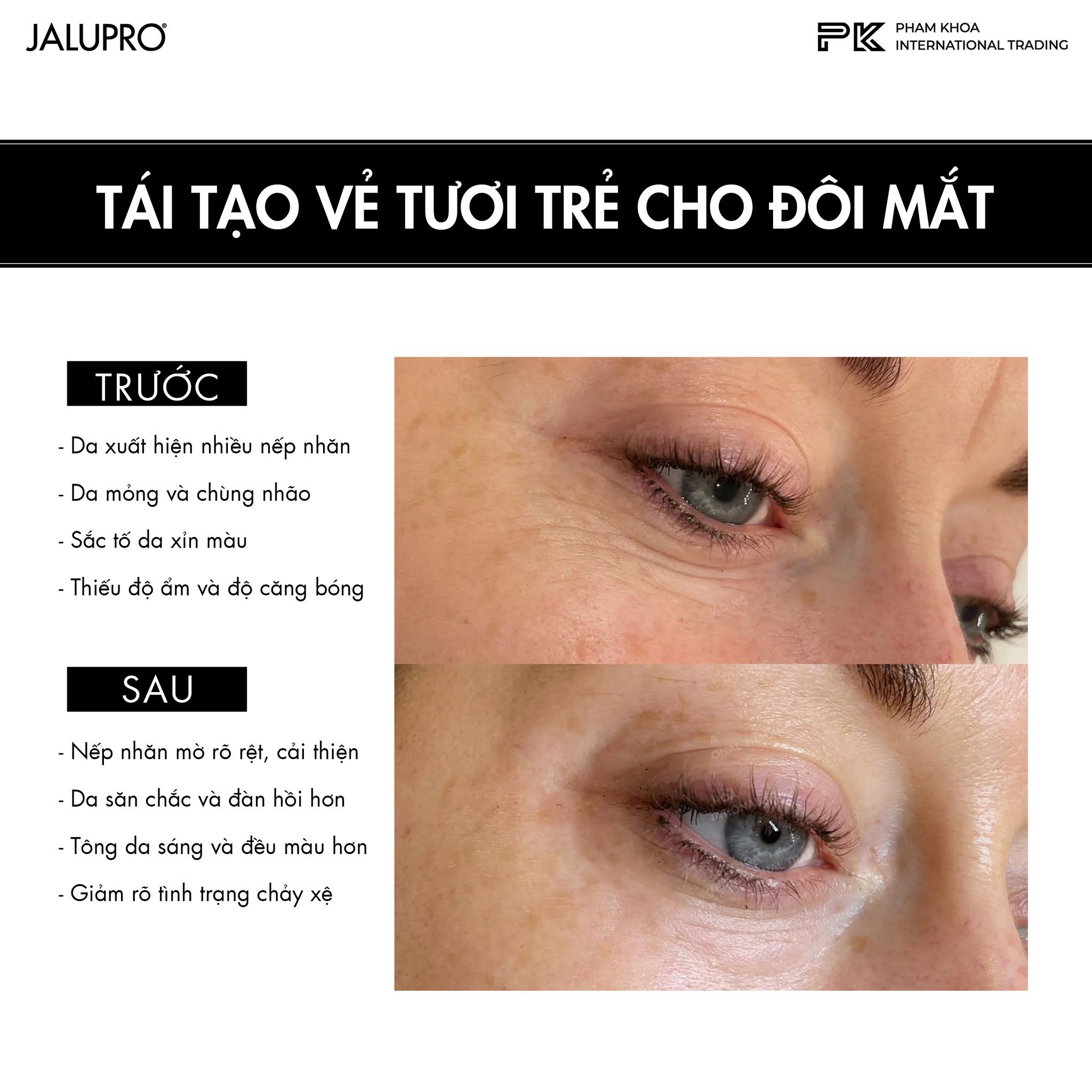 Tinh Chất Trẻ Hóa Vùng Mắt, Hỗ Trợ Làm Đầy & Cải Thiện Da Mắt Jalupro Young Eye 1ml Chính Hãng