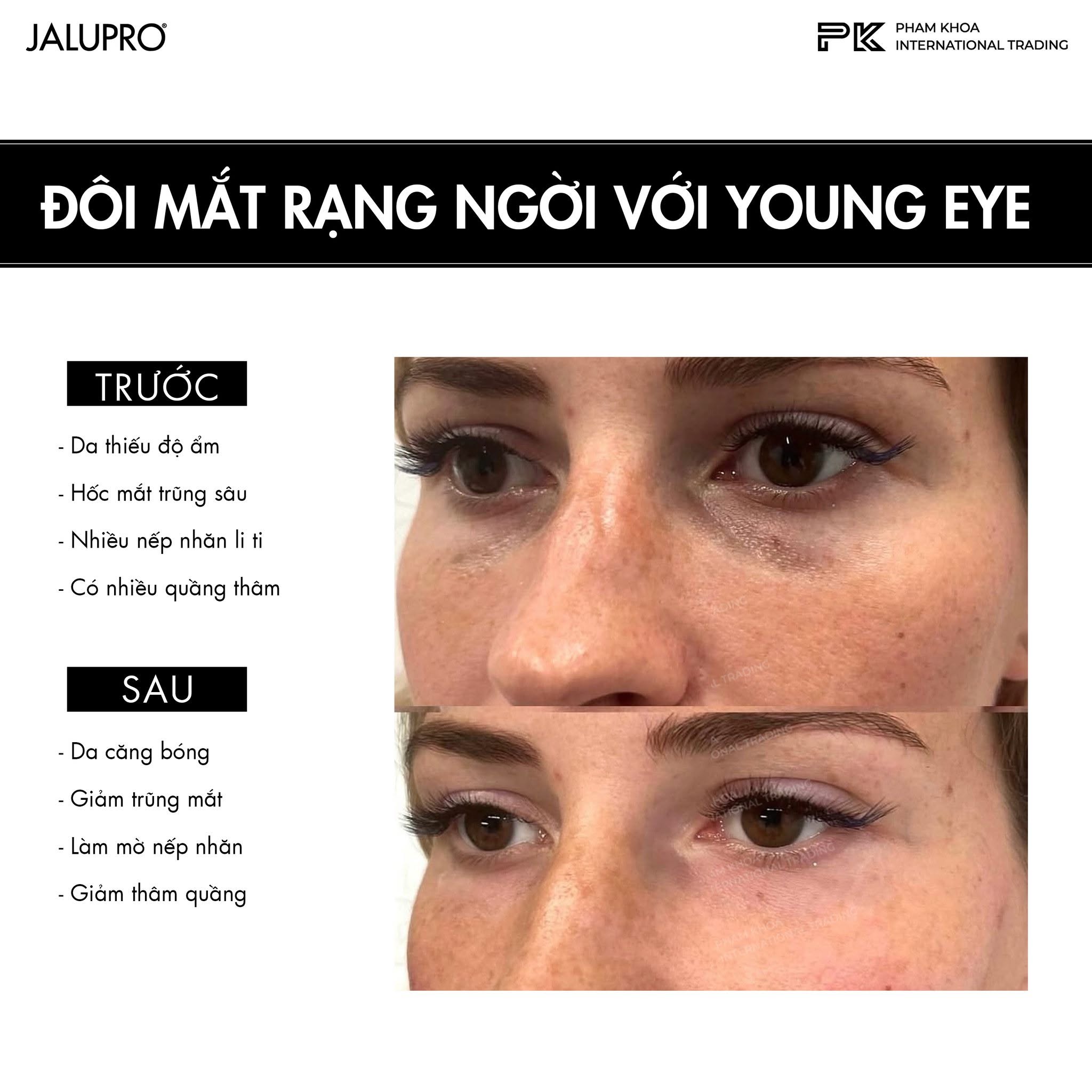 Tinh Chất Trẻ Hóa Vùng Mắt, Hỗ Trợ Làm Đầy & Cải Thiện Da Mắt Jalupro Young Eye 1ml Chính Hãng