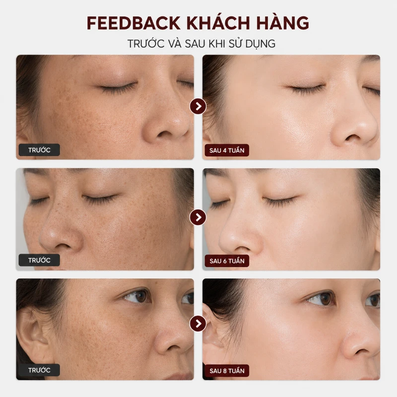 Tinh chất trắng da, mờ nám, tàn nhang Fusion F- Melaclear 10ml