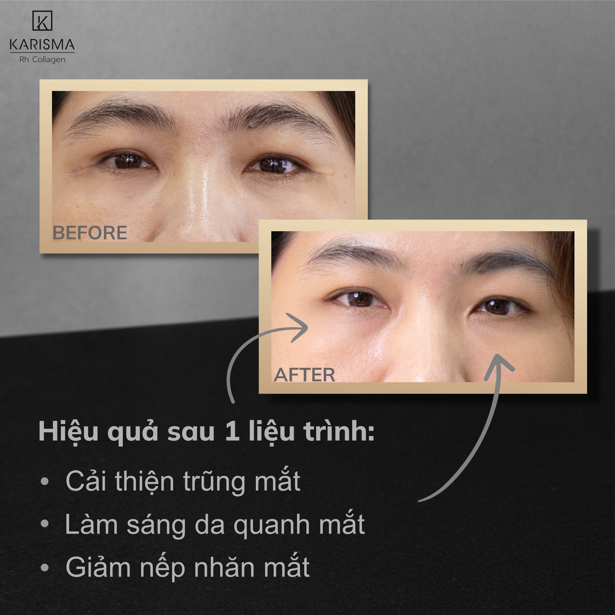 Tinh chất trẻ hóa da KARISMA Rh Collagen