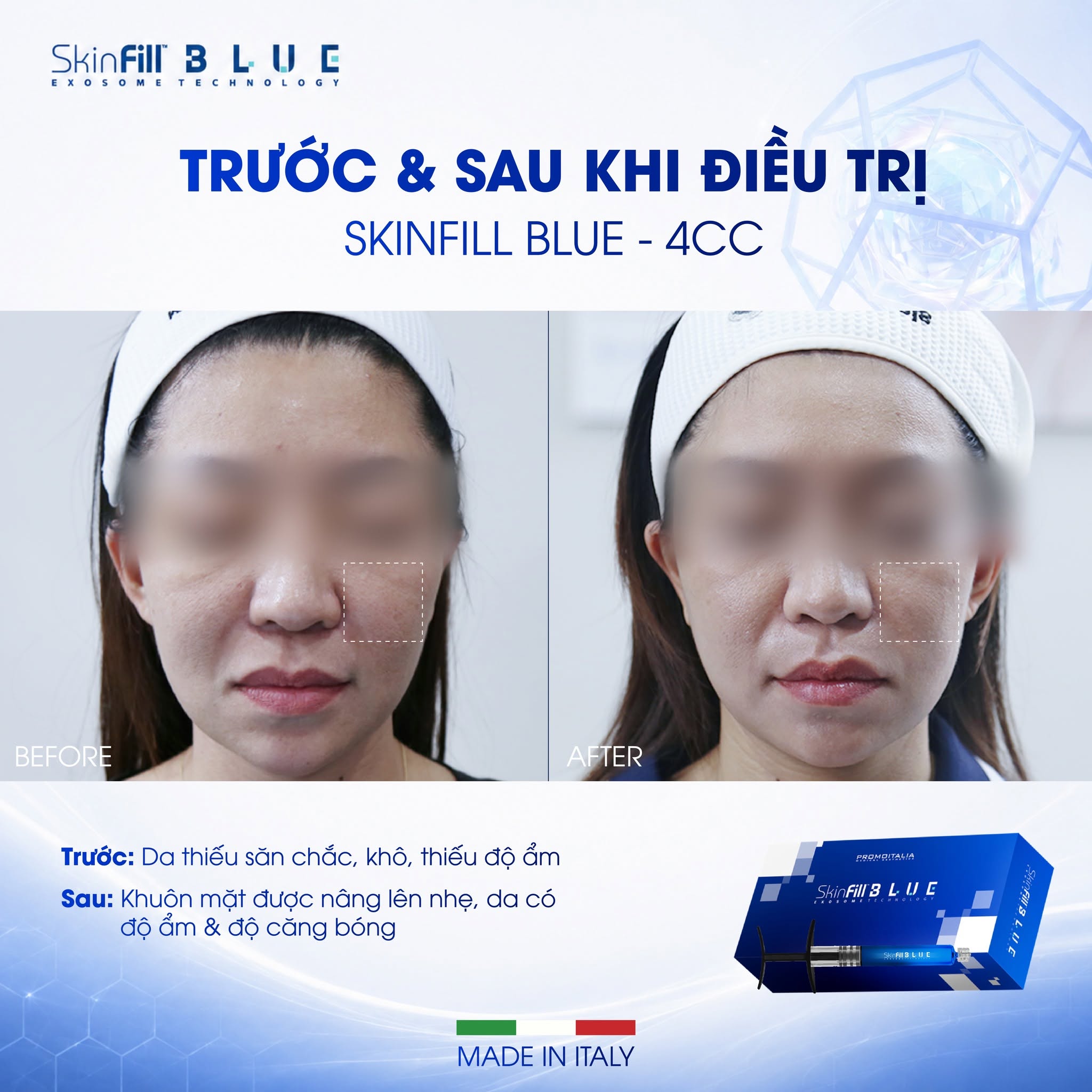Tinh chất BAP tái tạo đa tầng, trẻ hóa phục hồi cấu trúc da Skinfill Blue