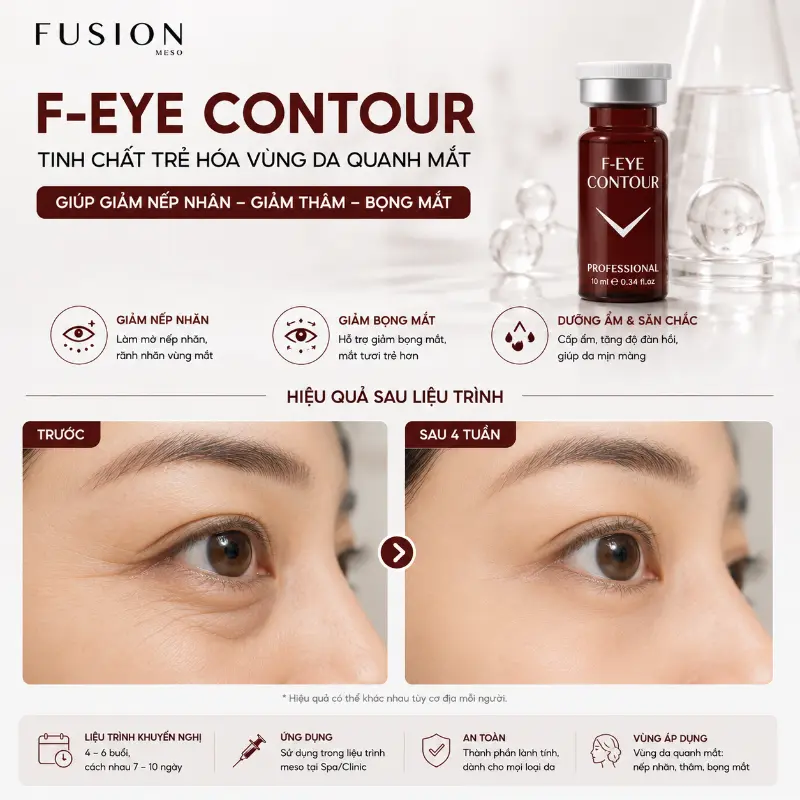 Tinh Chất Hỗ Trợ Cải Thiện Thâm Quầng & Nếp Nhăn Vùng Mắt Fusion F-Eye Contour 5ml Chính Hãng